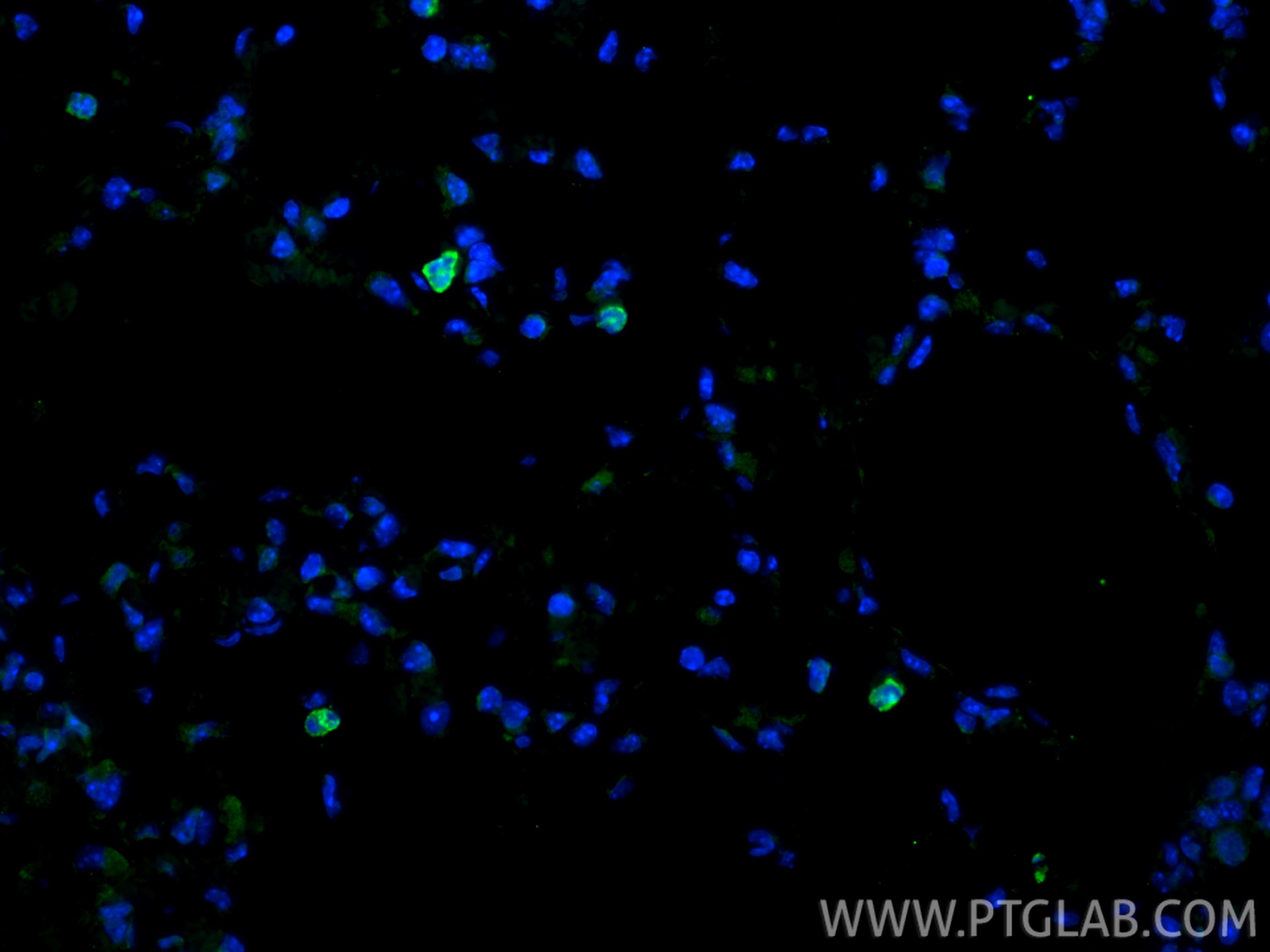 Immunofluorescence (IF) / fluorescent staining of mouse lung tissue using CD11b Polyclonal antibody (31745-1-AP)