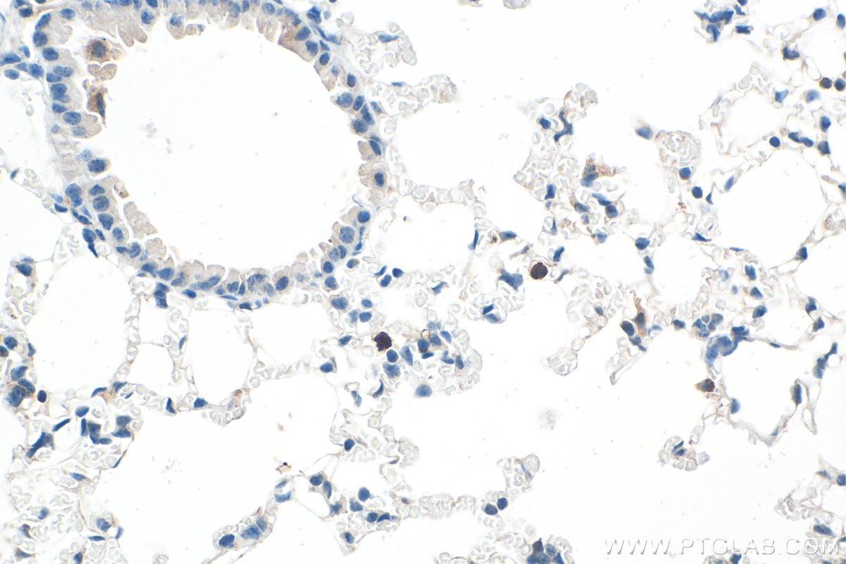 Immunohistochemistry (IHC) staining of mouse lung tissue using CD11b Polyclonal antibody (31745-1-AP)