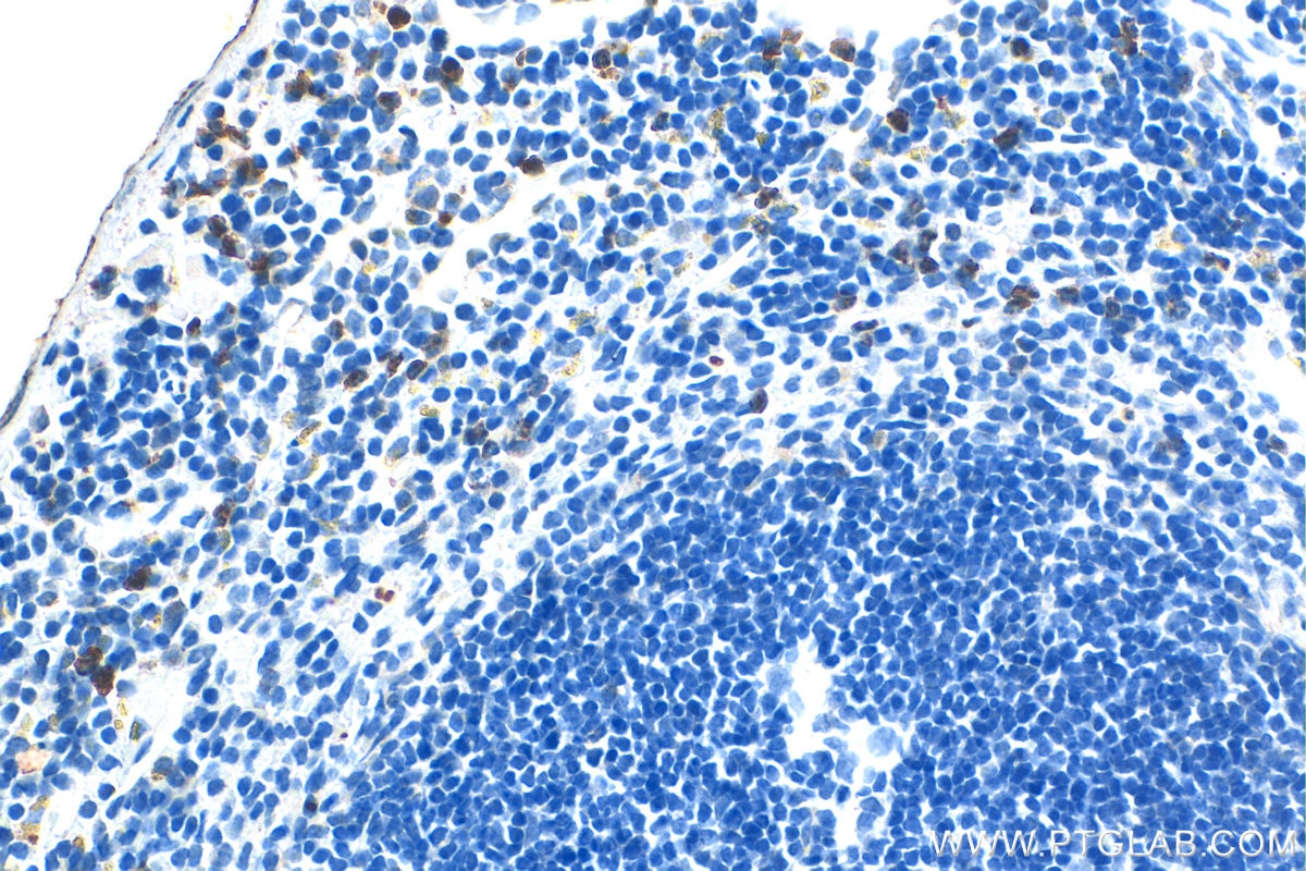 Immunohistochemistry (IHC) staining of mouse spleen tissue using CD11b Polyclonal antibody (31745-1-AP)