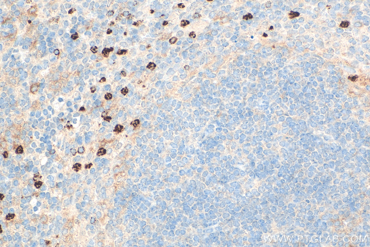 IHC staining of mouse spleen using 31745-1-AP Immunohistochemistry (IHC) staining of mouse spleen tissue using CD11b Polyclonal antibody (31745-1-AP)