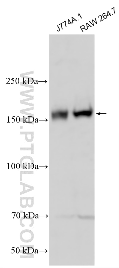Western Blot (WB) analysis of various lysates using CD11b Polyclonal antibody (31745-1-AP)