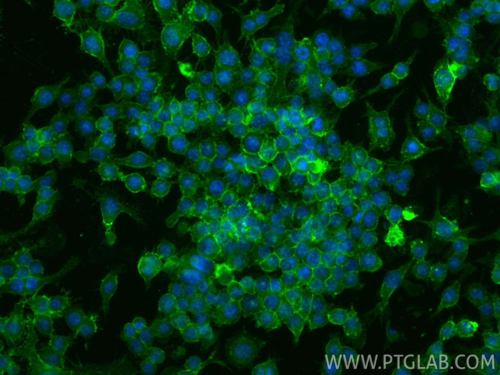 Immunofluorescence (IF) / fluorescent staining of RAW 264.7 cells using Anti-Mouse CD11b (M1/70) Rat IgG2a Recombinant Ant (65672-1-TR)
