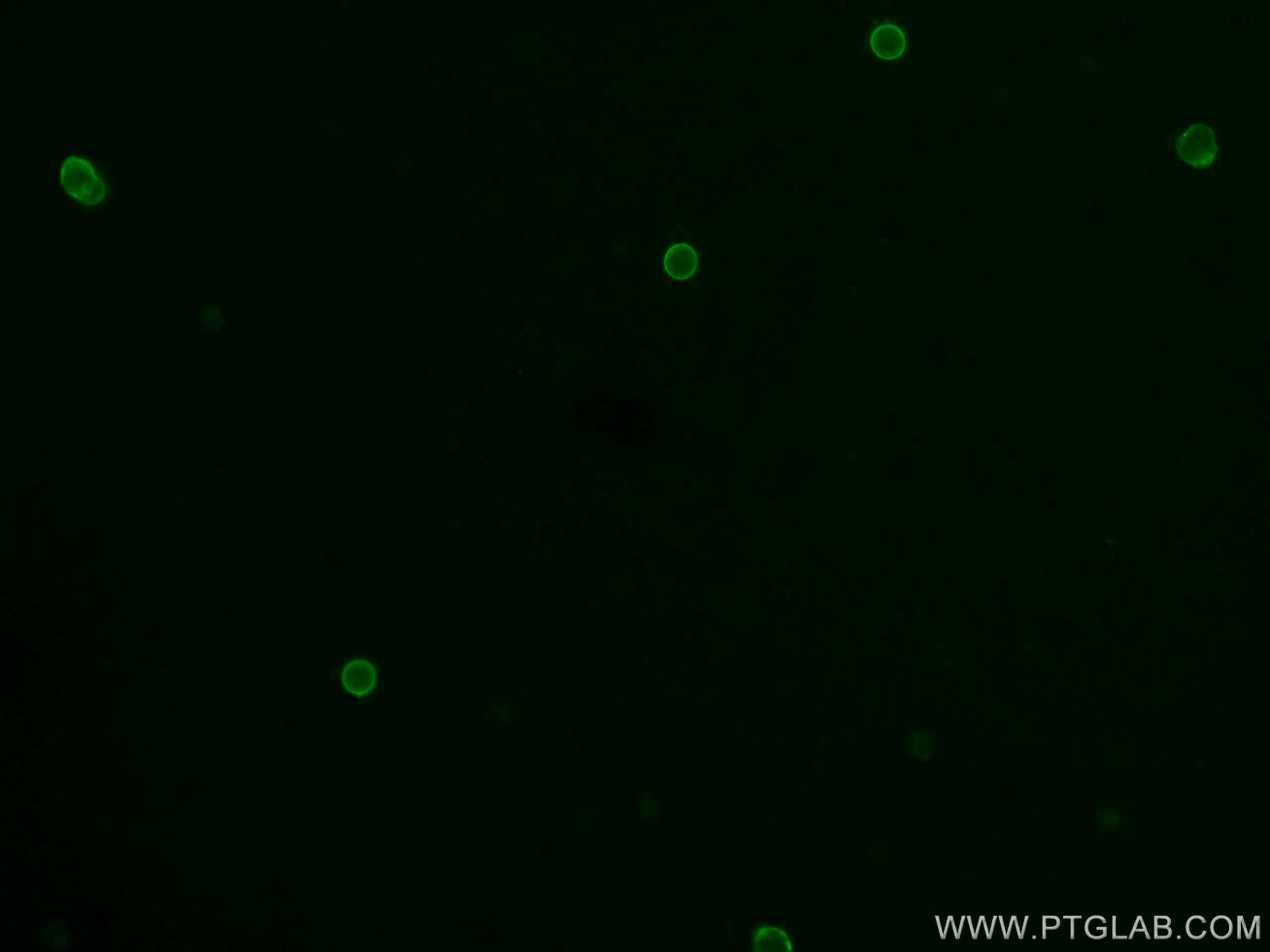 IF Staining of mouse splenocytes using CL488-65055