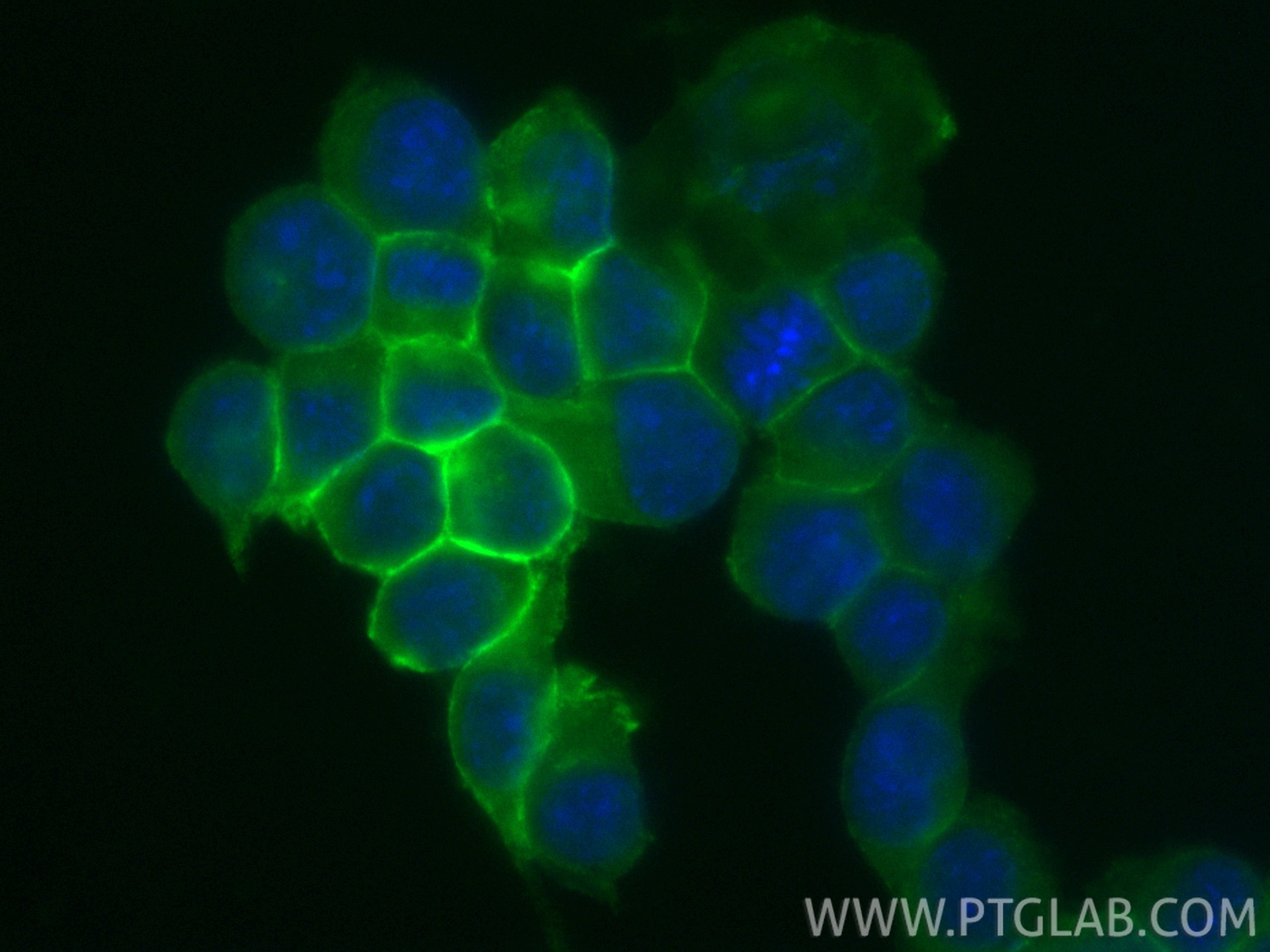Immunofluorescence (IF) / fluorescent staining of BV-2 cells using CoraLite® Plus 488 Anti-Mouse CD11b (M1/70) (CL488-65055)