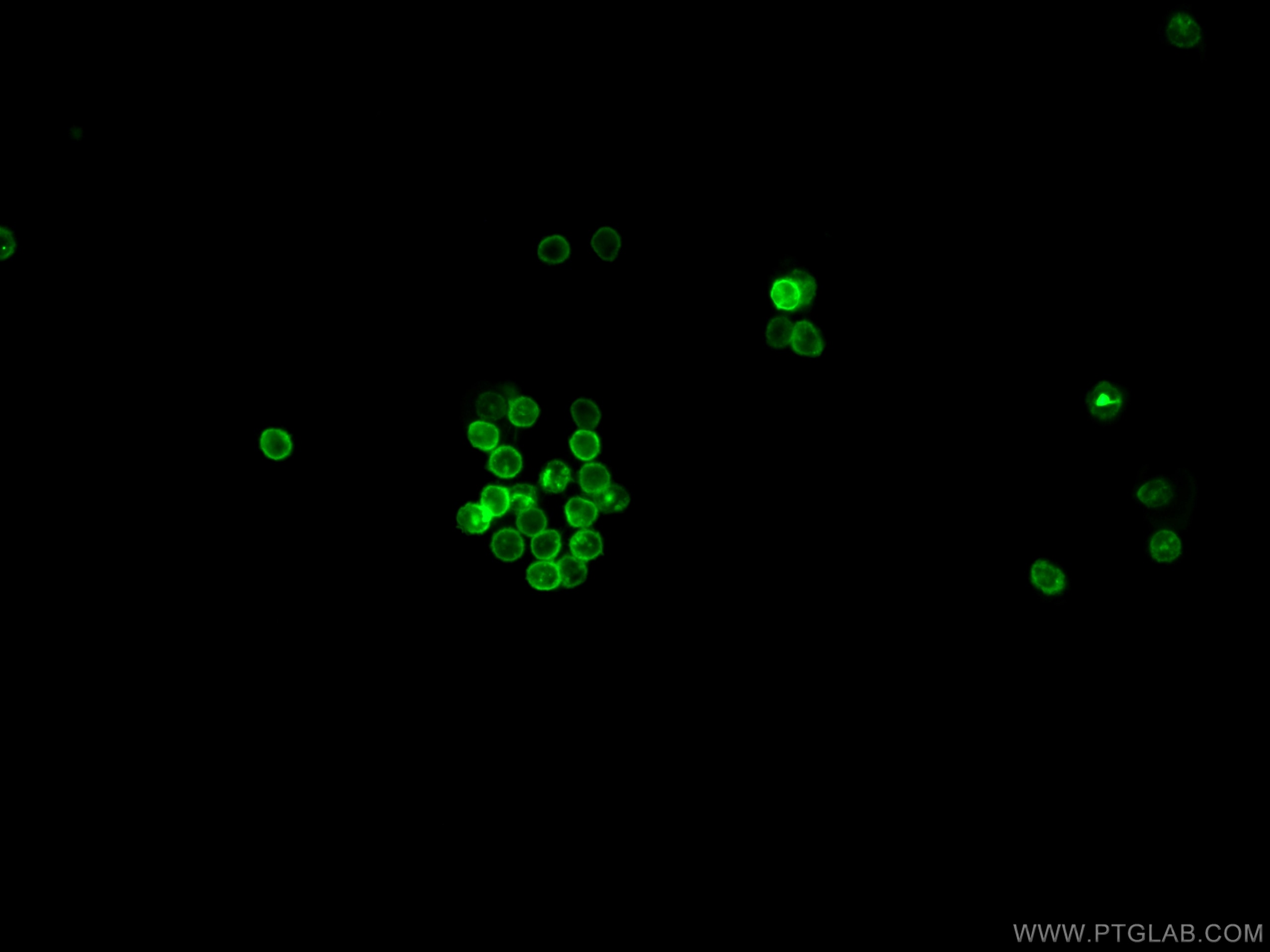 Immunofluorescence (IF) / fluorescent staining of human peripheral blood mononuclear cells using CoraLite® Plus 488 Anti-Human CD11b (ICRF44) (CL488-65116)