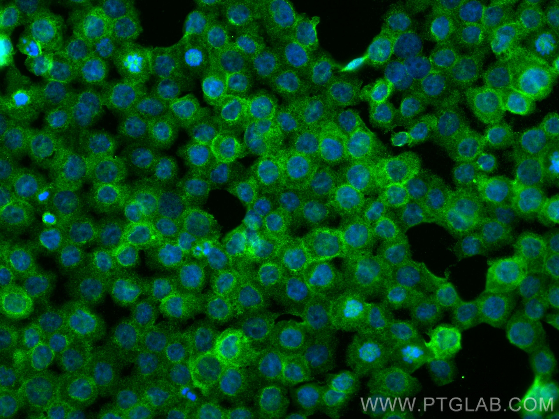Immunofluorescence (IF) / fluorescent staining of THP-1 cells using CD11c/Integrin alpha X Recombinant antibody (81853-1-RR)