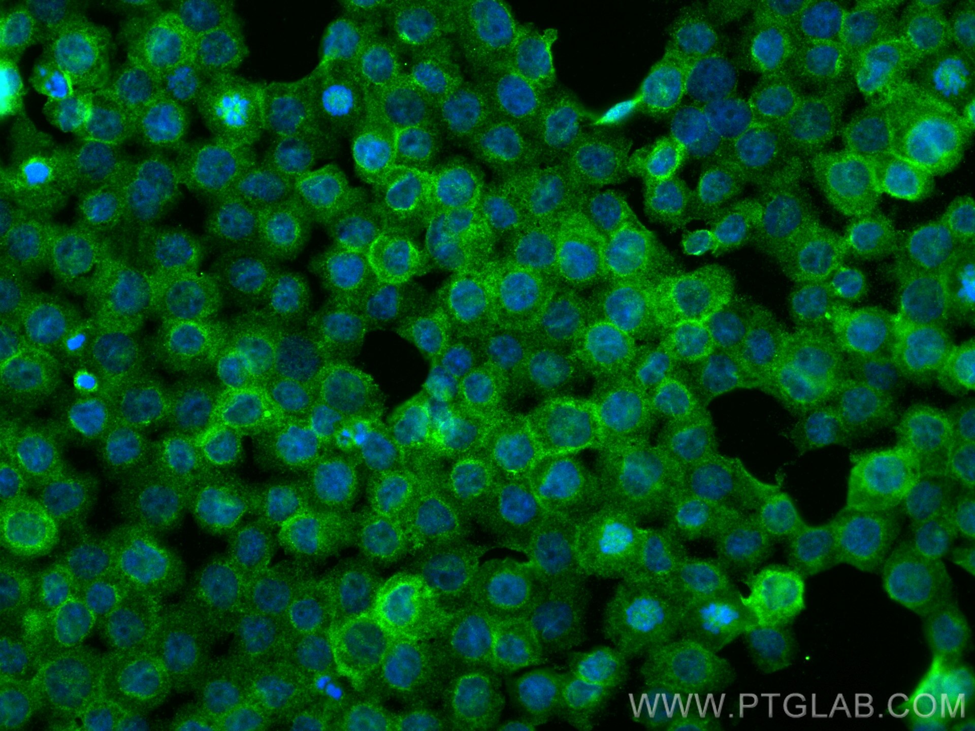 IF Staining of THP-1 using 81853-1-RR