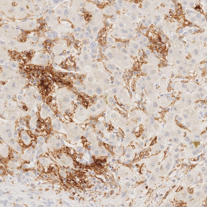 IHC staining of human liver using 81853-1-RR Immunohistochemistry (IHC) staining of human liver tissue using CD11c Recombinant monoclonal antibody (81853-1-RR)