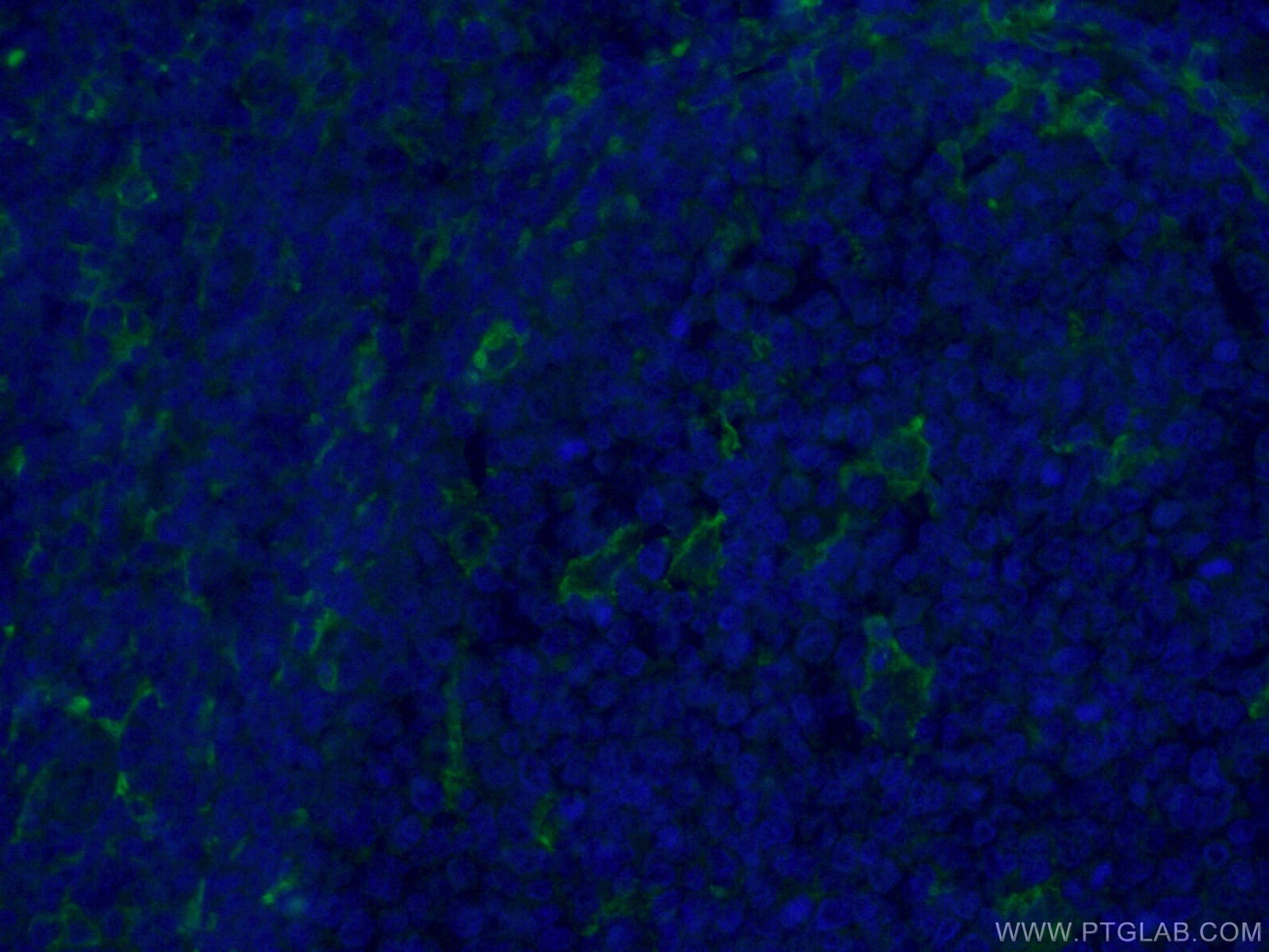 CD11c/Integrin Alpha X