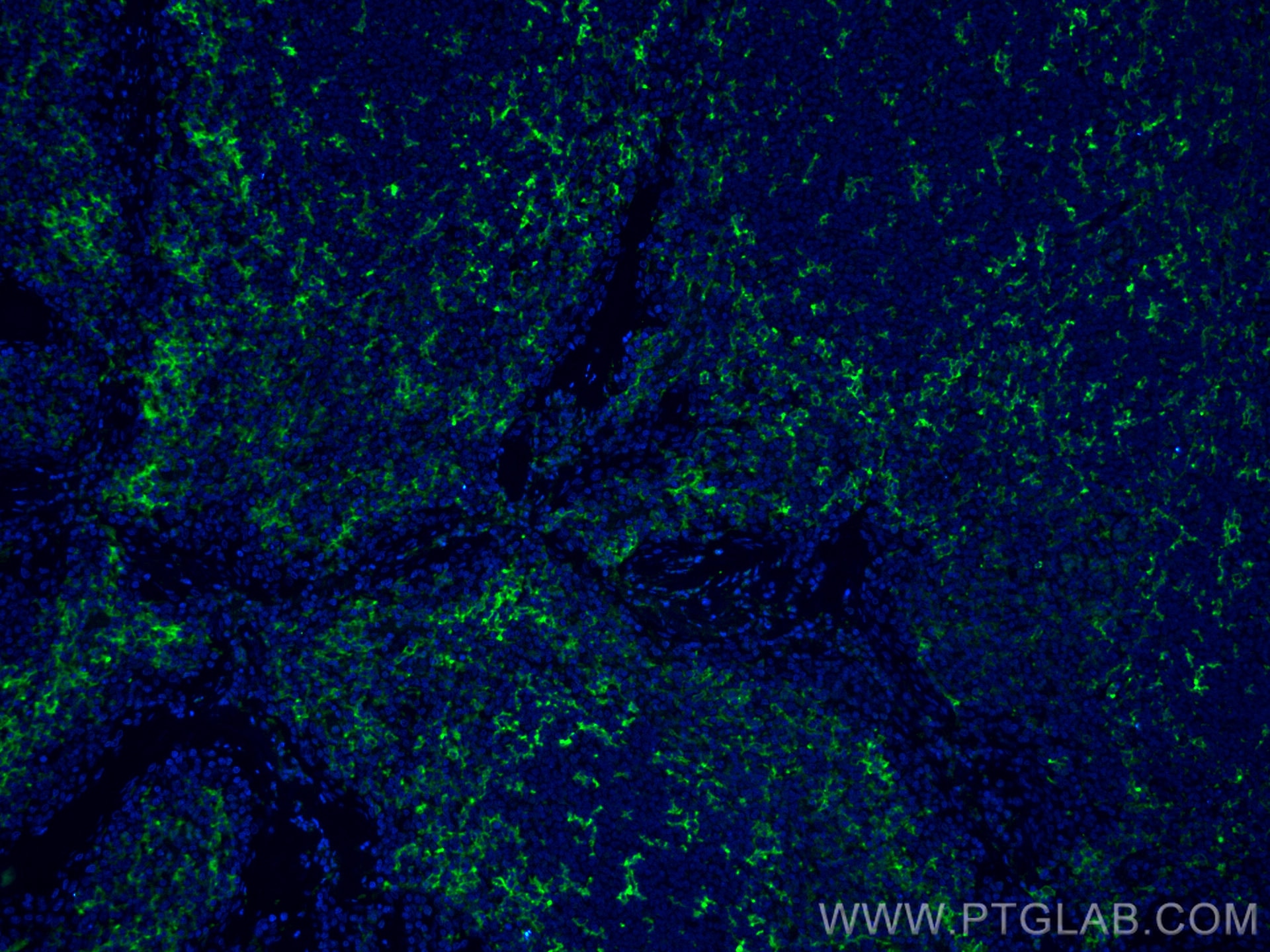 Immunofluorescence (IF) / fluorescent staining of human tonsillitis tissue using CoraLite® Plus 488-conjugated CD11c/Integrin Alpha (CL488-60258)