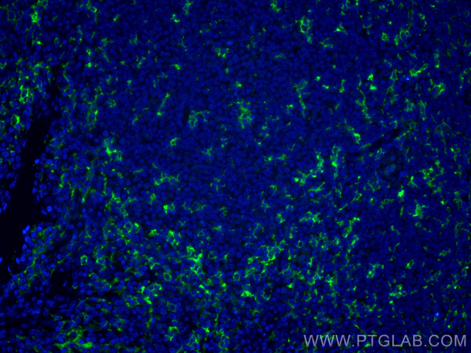 Immunofluorescence (IF) / fluorescent staining of human tonsillitis tissue using CoraLite® Plus 488-conjugated CD11c/Integrin Alpha (CL488-60258)