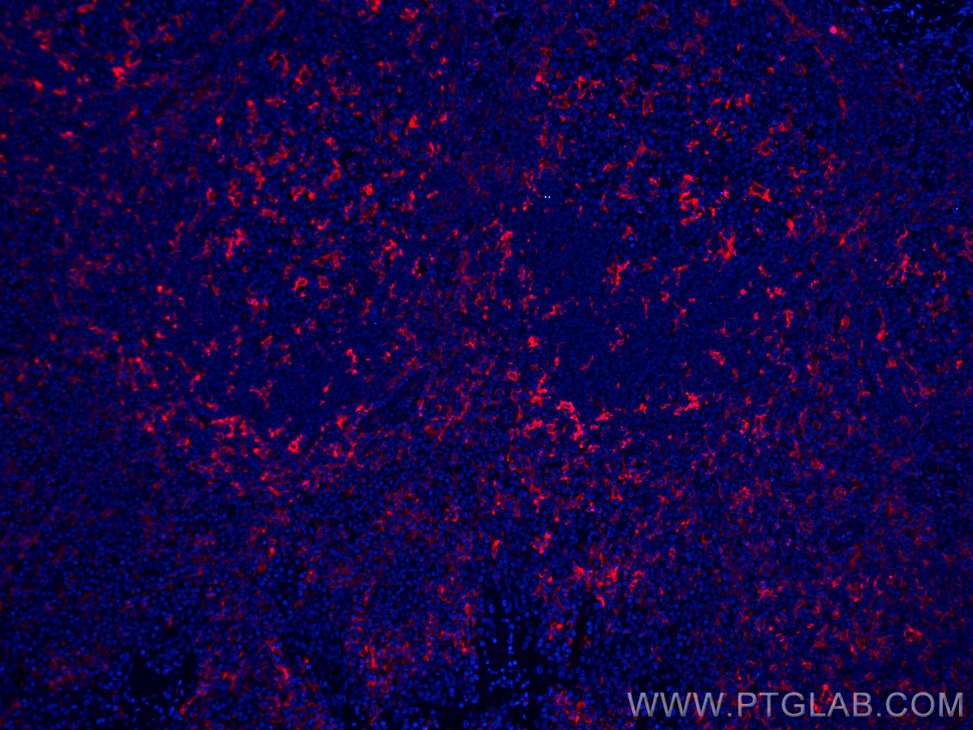 Immunofluorescence (IF) / fluorescent staining of human tonsillitis tissue using CoraLite®594-conjugated CD11c/Integrin Alpha X Mon (CL594-60258)