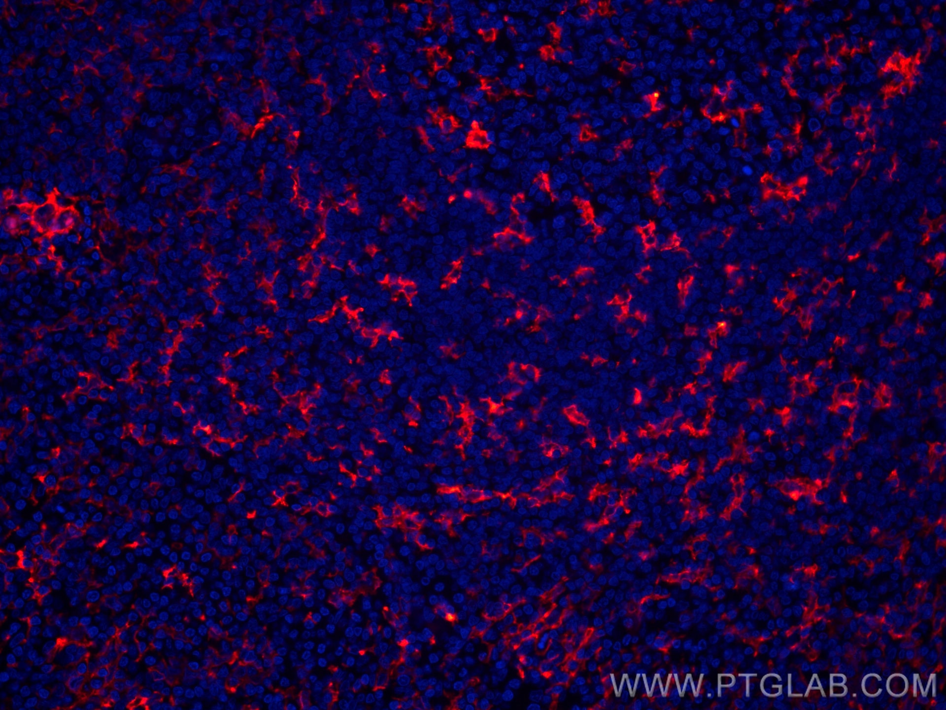 IF Staining of human tonsillitis using CL594-60258