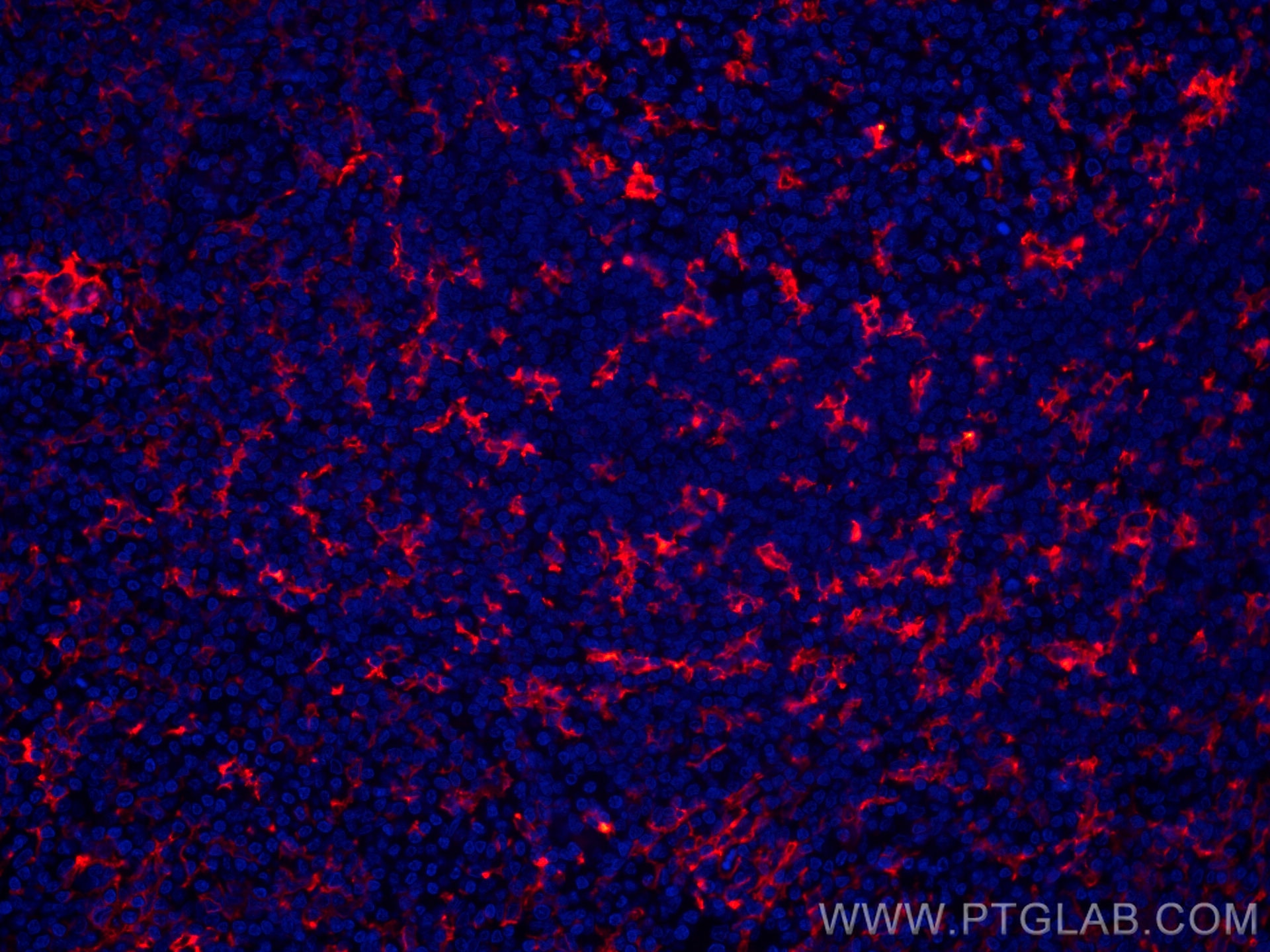 Immunofluorescence (IF) / fluorescent staining of human tonsillitis tissue using CoraLite®594-conjugated CD11c/Integrin Alpha X Mon (CL594-60258)