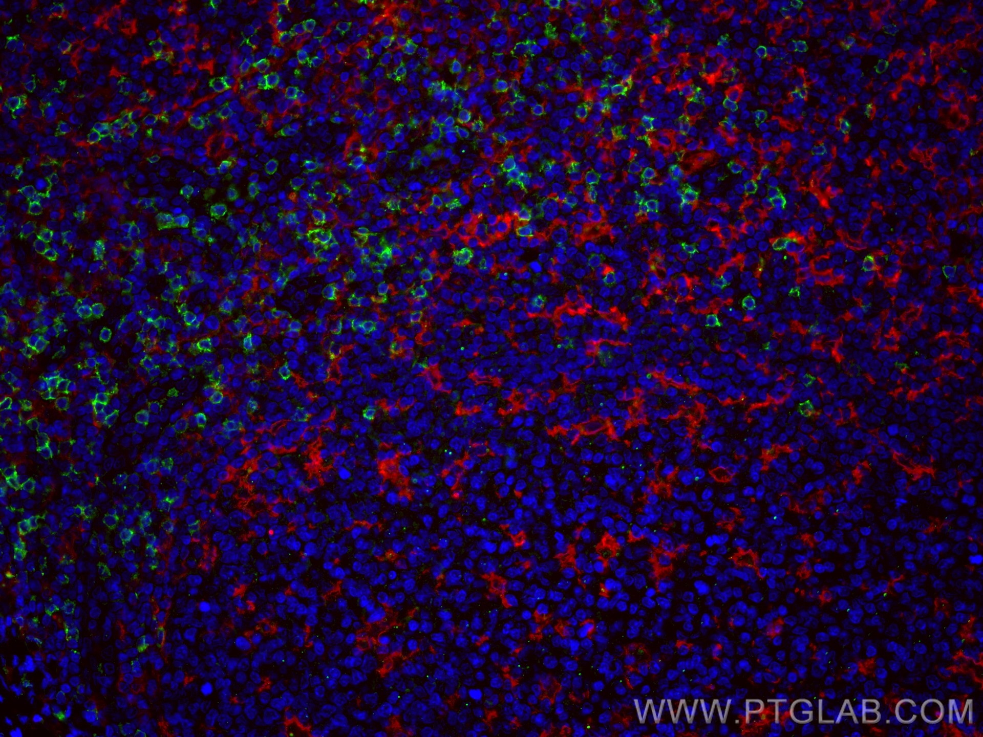 Immunofluorescence (IF) / fluorescent staining of human tonsillitis tissue using CoraLite®594-conjugated CD11c/Integrin Alpha X Mon (CL594-60258)