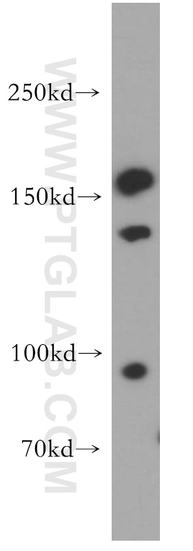 Western Blot (WB) analysis of Jurkat cells using CD11d/Integrin Alpha D Polyclonal antibody (55162-1-AP)