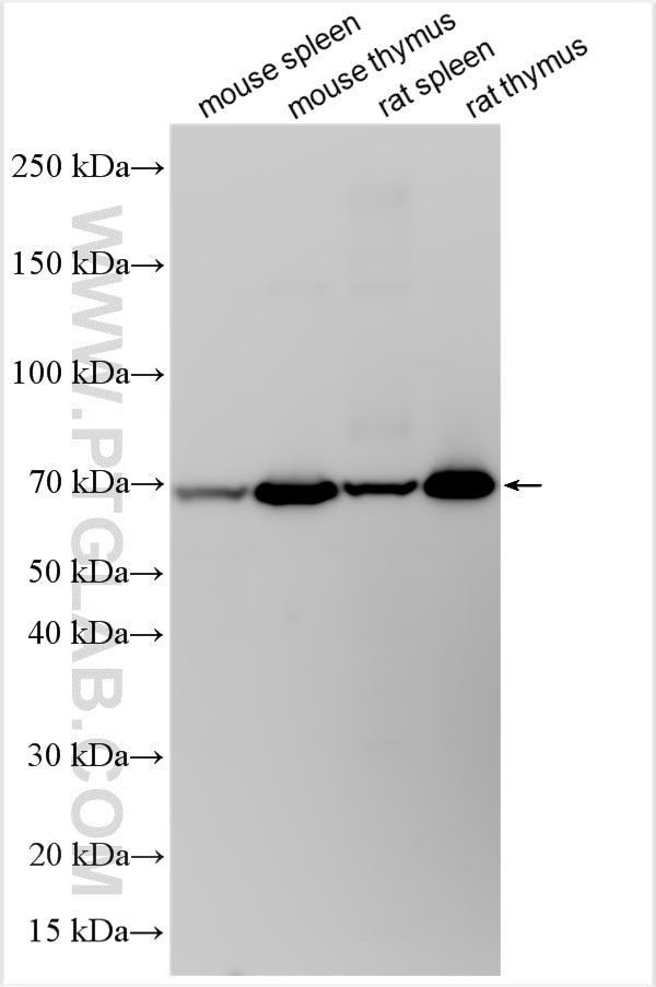 Western Blot (WB) analysis of various lysates using CD122/IL-2RB Polyclonal antibody (32546-1-AP)