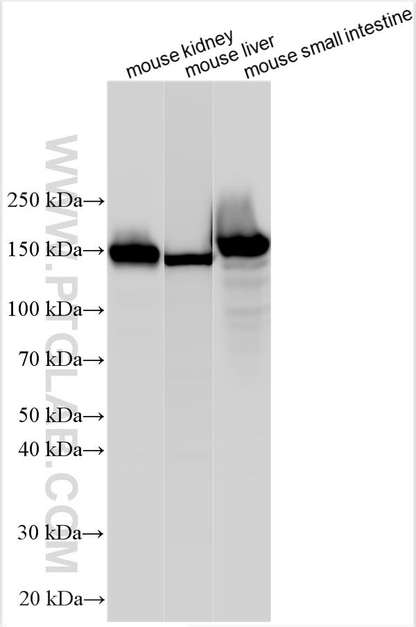 Western Blot (WB) analysis of various lysates using CD13 Polyclonal antibody (32752-1-AP)