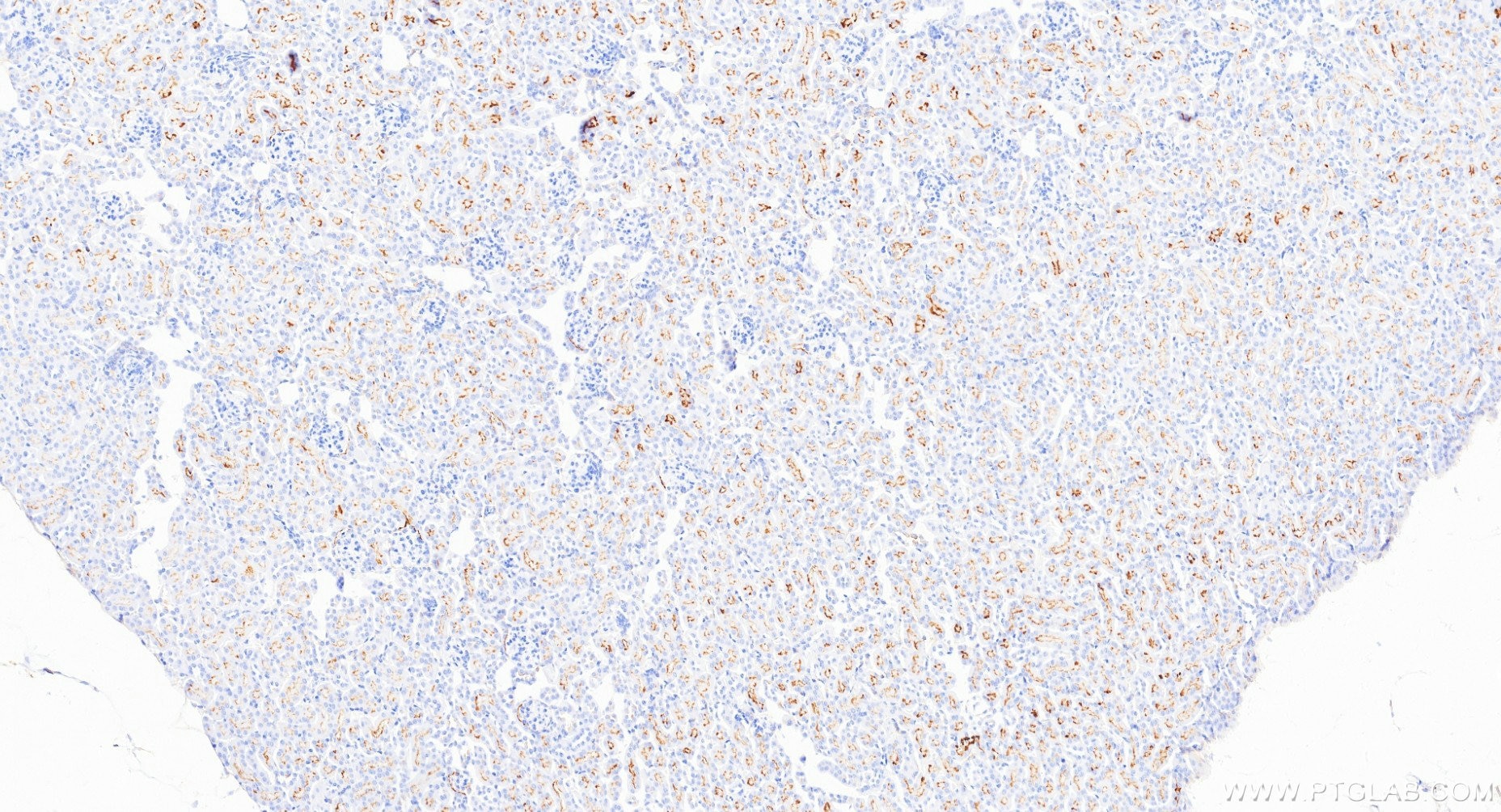 Immunohistochemistry (IHC) staining of mouse kidney tissue using CD13 Recombinant monoclonal antibody (85152-6-RR)
