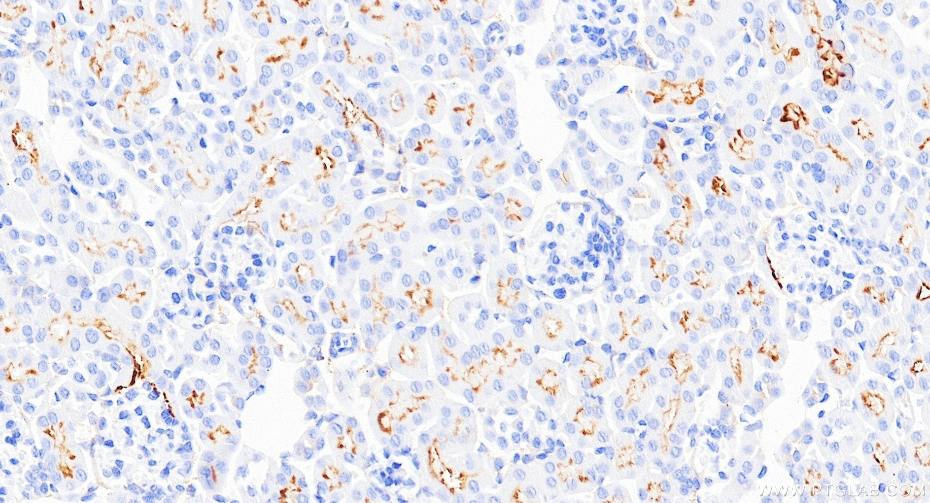 Immunohistochemistry (IHC) staining of mouse kidney tissue using CD13 Recombinant monoclonal antibody (85152-6-RR)