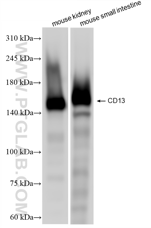 Western Blot (WB) analysis of various lysates using CD13 Recombinant monoclonal antibody (85152-6-RR)