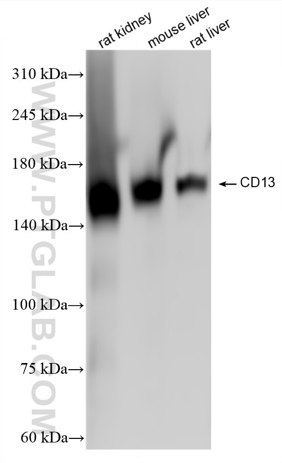 Western Blot (WB) analysis of various lysates using CD13 Recombinant monoclonal antibody (85152-6-RR)