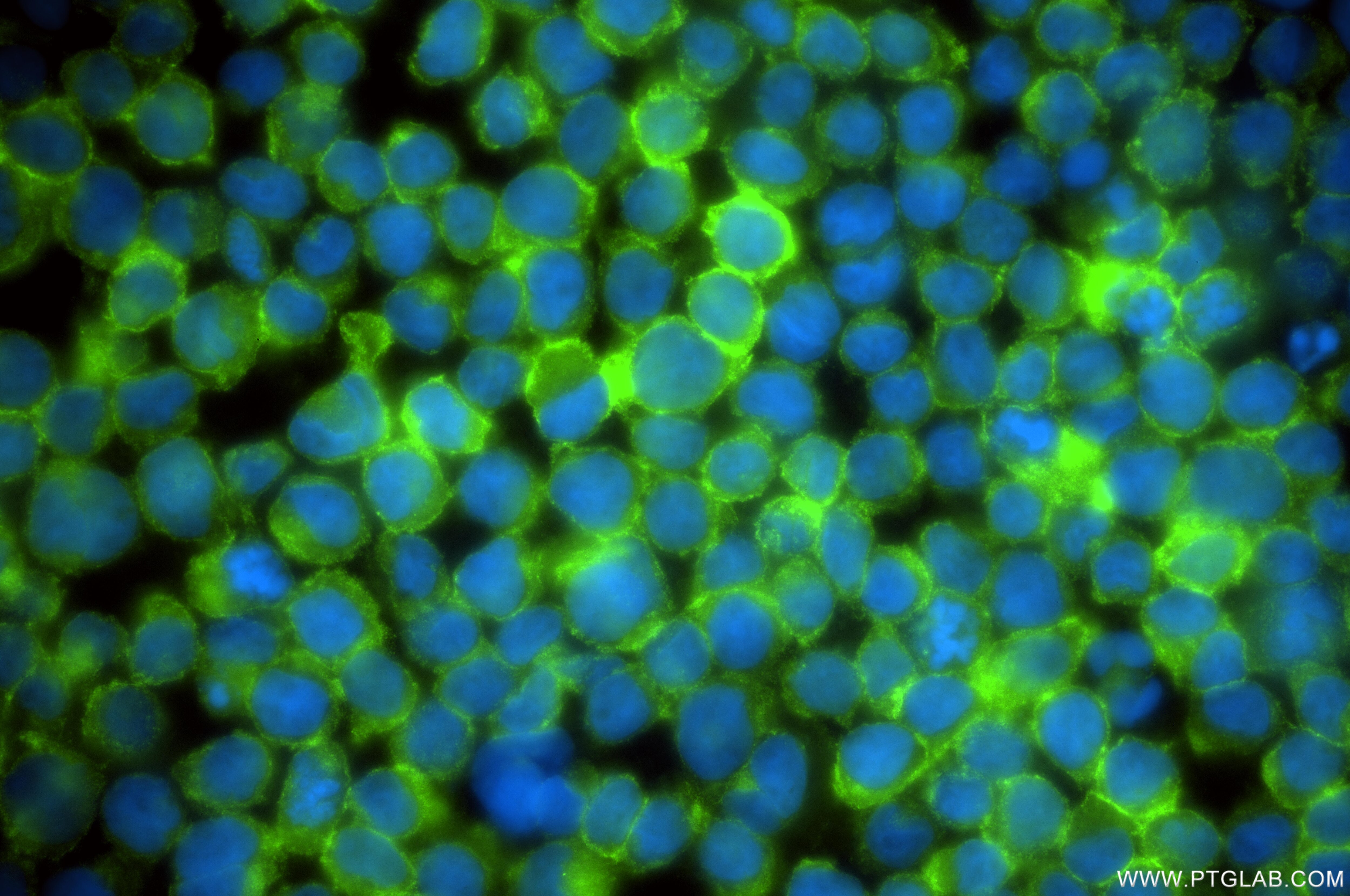 IF Staining of THP-1 using 86620-3-RR Immunofluorescence (IF) / fluorescent staining of THP-1 cells using CD13 Recombinant monoclonal antibody (86620-3-RR)