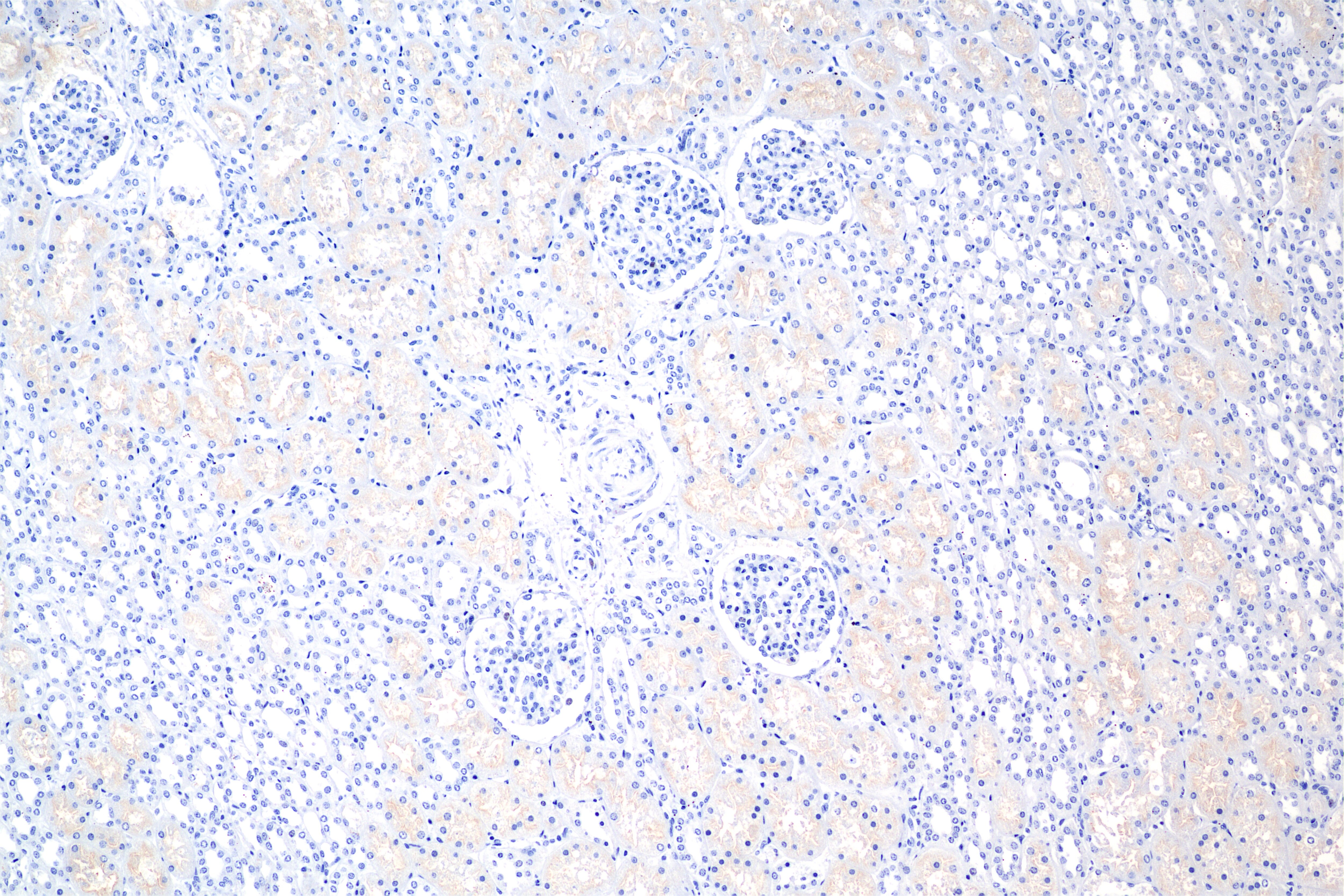 IHC staining of human kidney using 86620-3-RR Immunohistochemistry (IHC) staining of human kidney tissue using CD13 Recombinant monoclonal antibody (86620-3-RR)