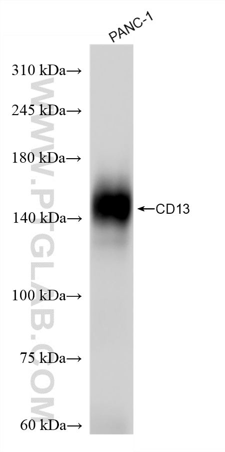 WB analysis of PANC-1 using 86620-3-RR Western Blot (WB) analysis of PANC-1 cells using CD13 Recombinant monoclonal antibody (86620-3-RR)