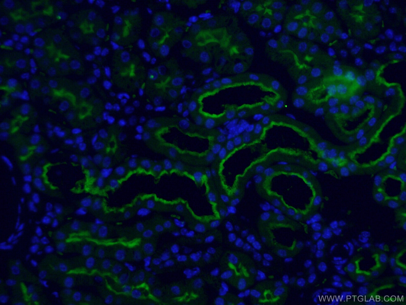 IF Staining of mouse kidney using CL488-66211