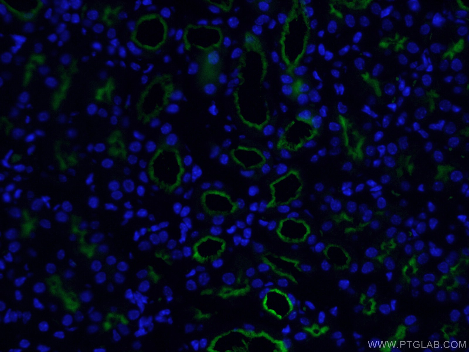 IF Staining of mouse kidney using CL488-66211