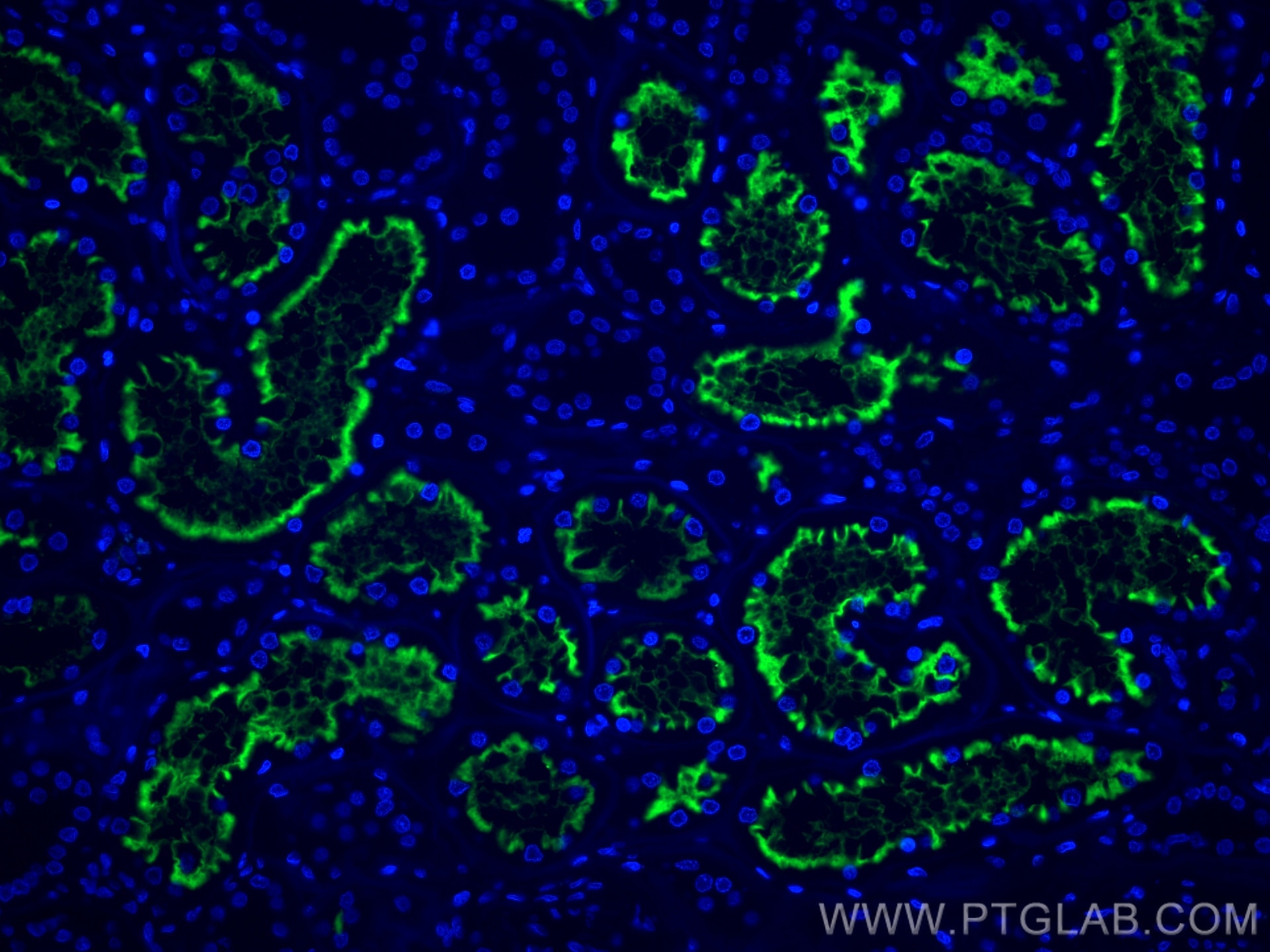 Immunofluorescence (IF) / fluorescent staining of human kidney tissue using CoraLite®488-conjugated CD13 Monoclonal antibody (CL488-66211)