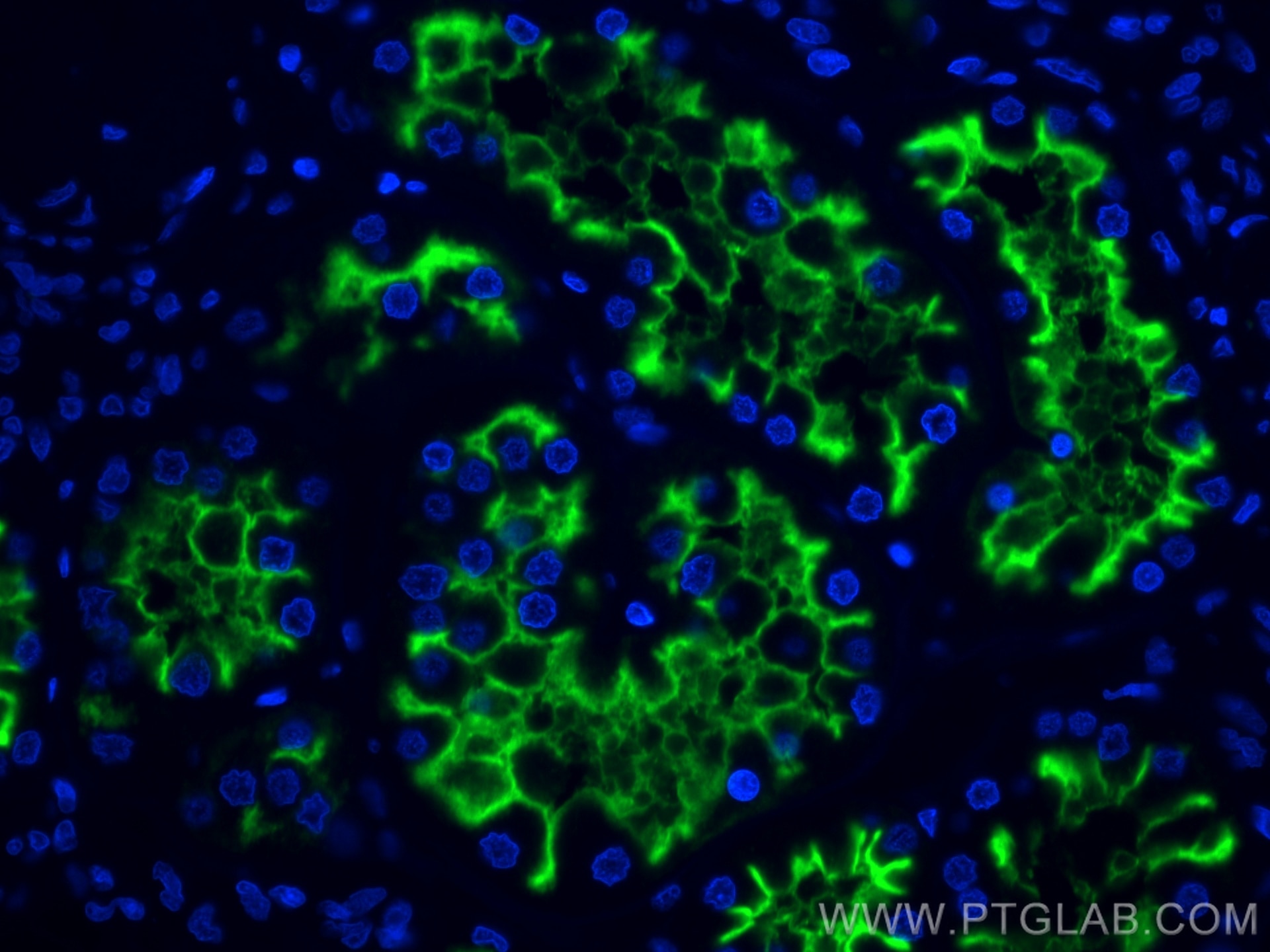 Immunofluorescence (IF) / fluorescent staining of human kidney tissue using CoraLite®488-conjugated CD13 Monoclonal antibody (CL488-66211)