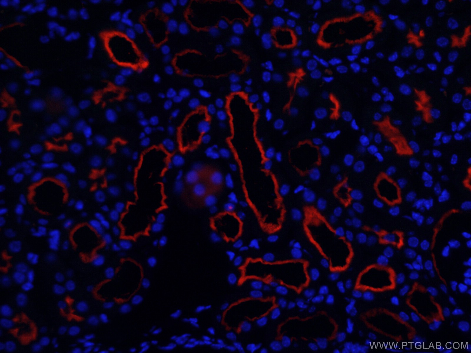 IF Staining of mouse kidney using CL594-66211