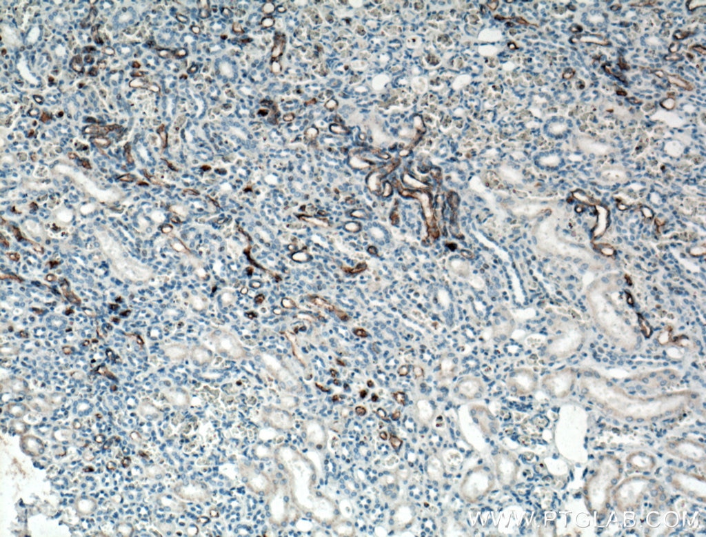 Immunohistochemistry (IHC) staining of human kidney tissue using CD133 Monoclonal antibody (66666-1-Ig)