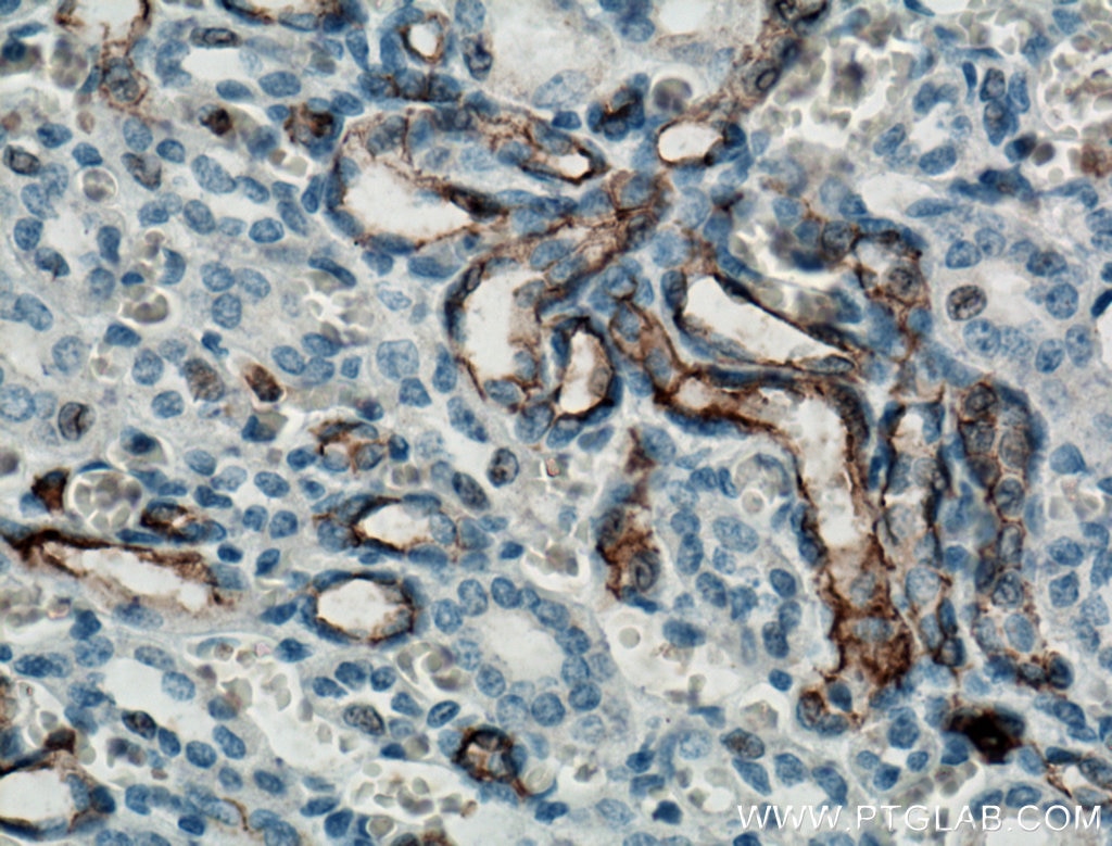 Immunohistochemistry (IHC) staining of human kidney tissue using CD133 Monoclonal antibody (66666-1-Ig)