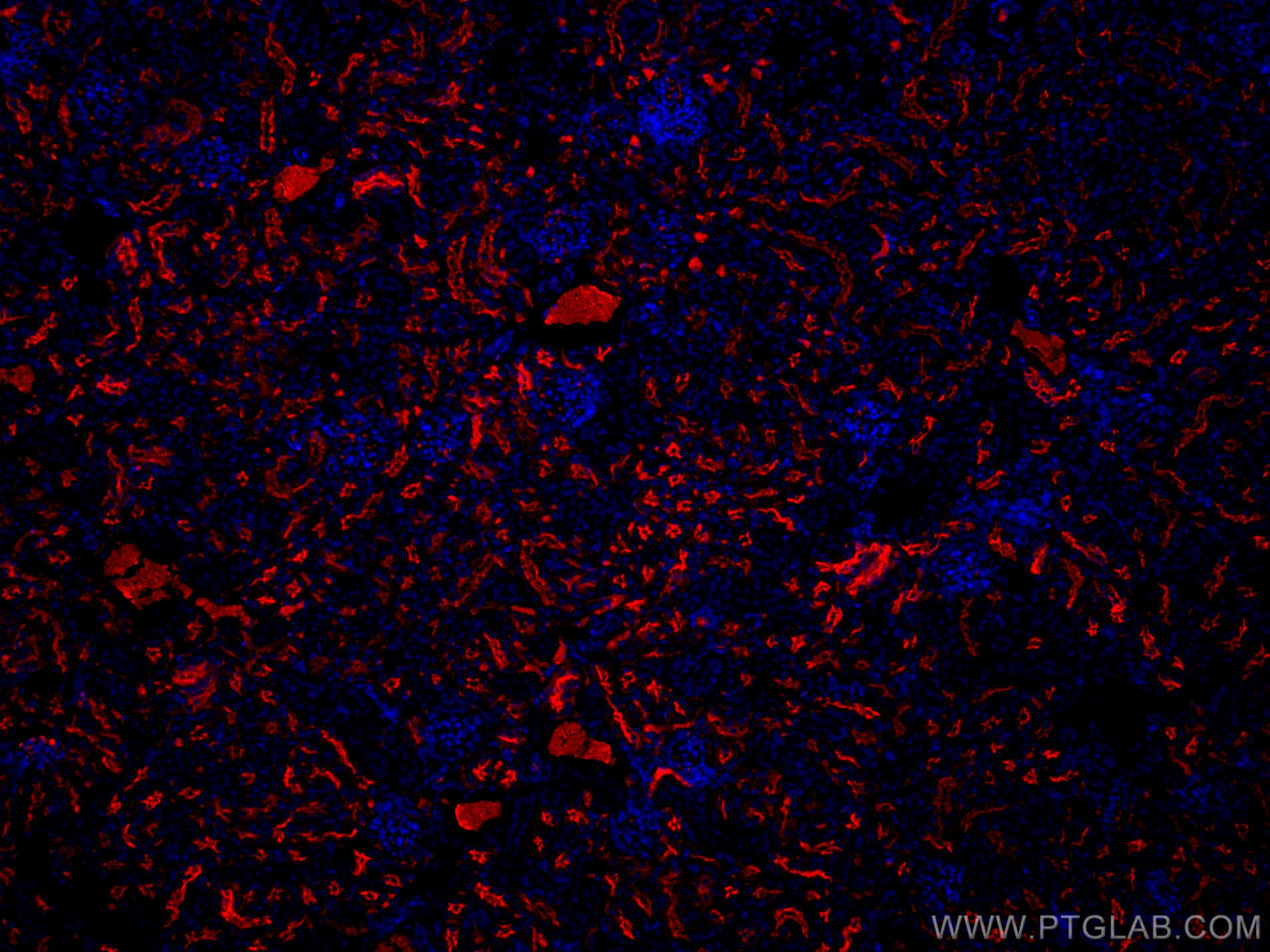 Immunofluorescence (IF) / fluorescent staining of mouse kidney tissue using CoraLite®594-conjugated CD133 Polyclonal antibody (CL594-18470)