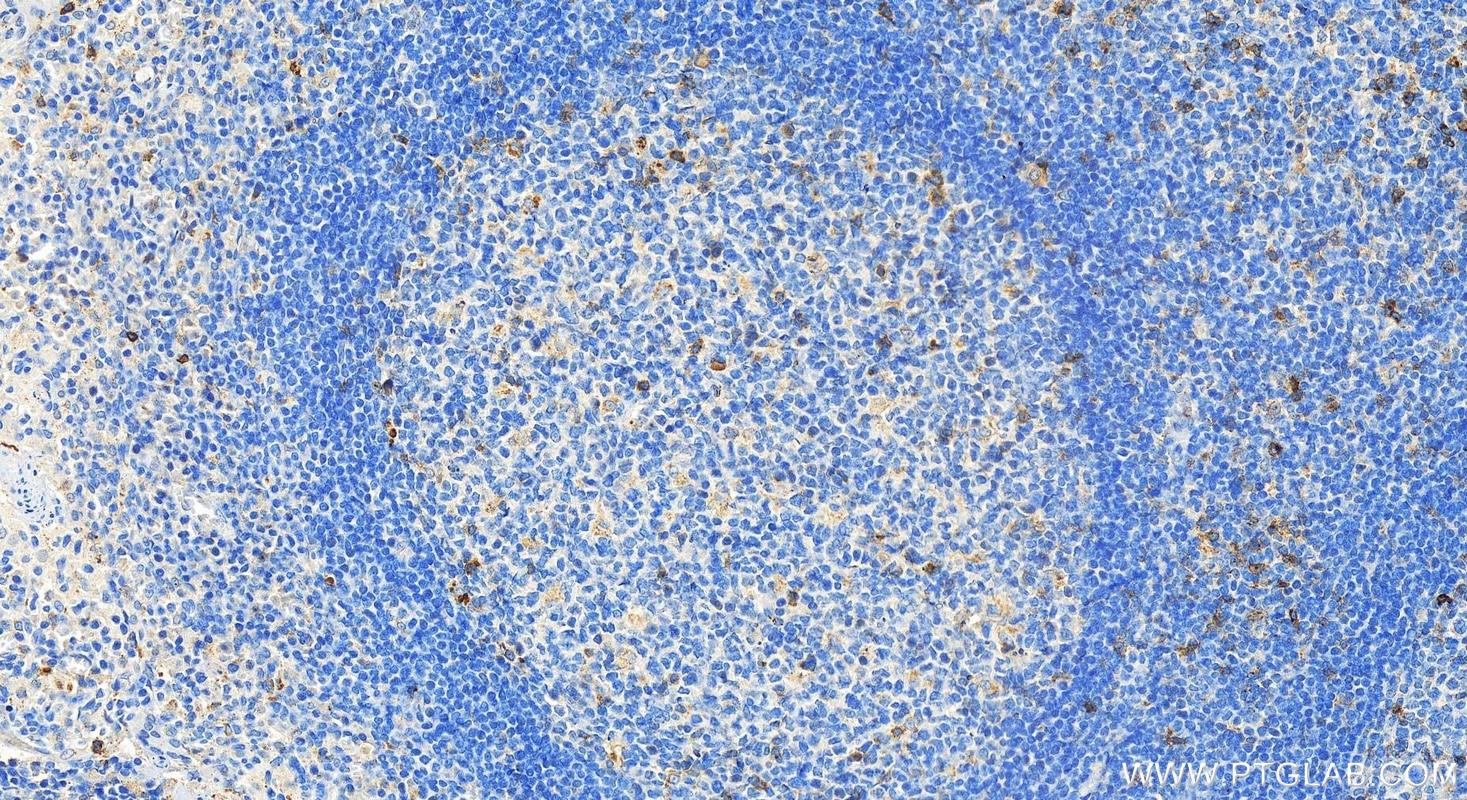 Immunohistochemistry (IHC) staining of human tonsillitis tissue using CD134/OX40 Polyclonal antibody (31805-1-AP)
