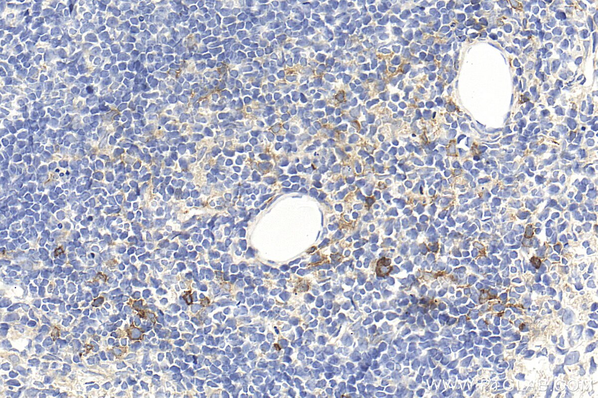 Immunohistochemistry (IHC) staining of mouse spleen tissue using CD134/OX40 Polyclonal antibody (32621-1-AP)