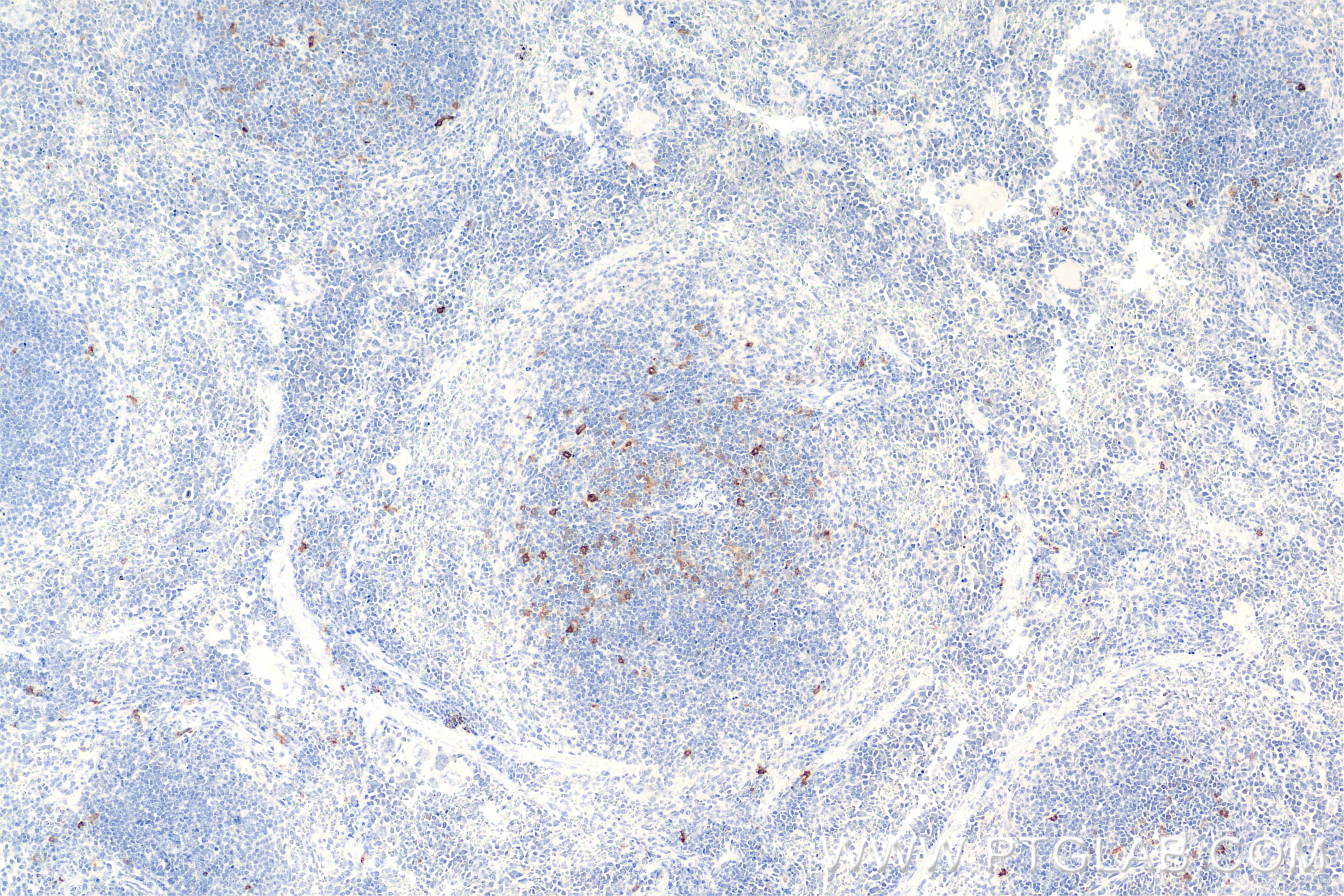 Immunohistochemistry (IHC) staining of mouse spleen tissue using CD134/OX40 Recombinant antibody (85620-4-RR)