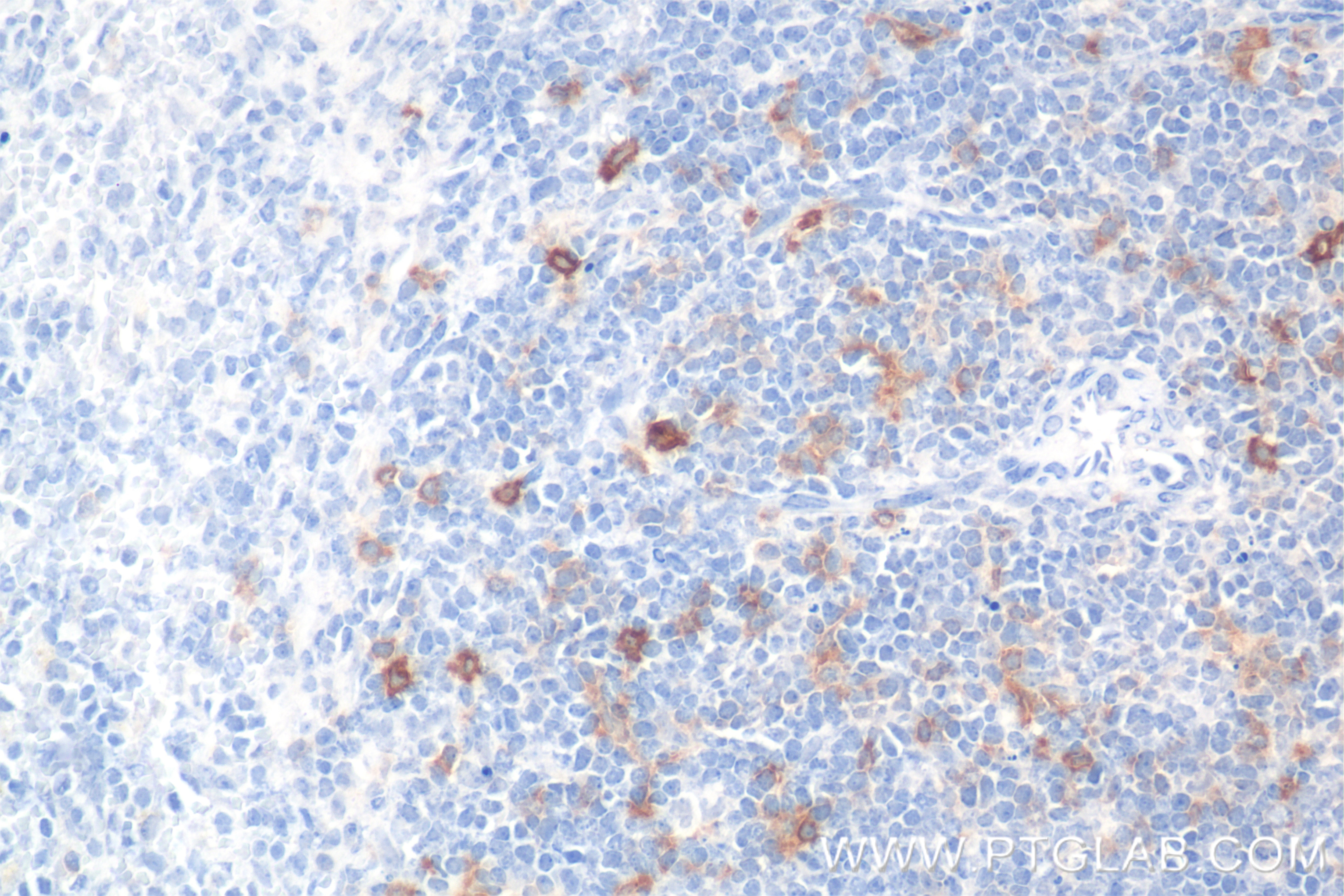 Immunohistochemistry (IHC) staining of mouse spleen tissue using CD134/OX40 Recombinant antibody (85620-4-RR)