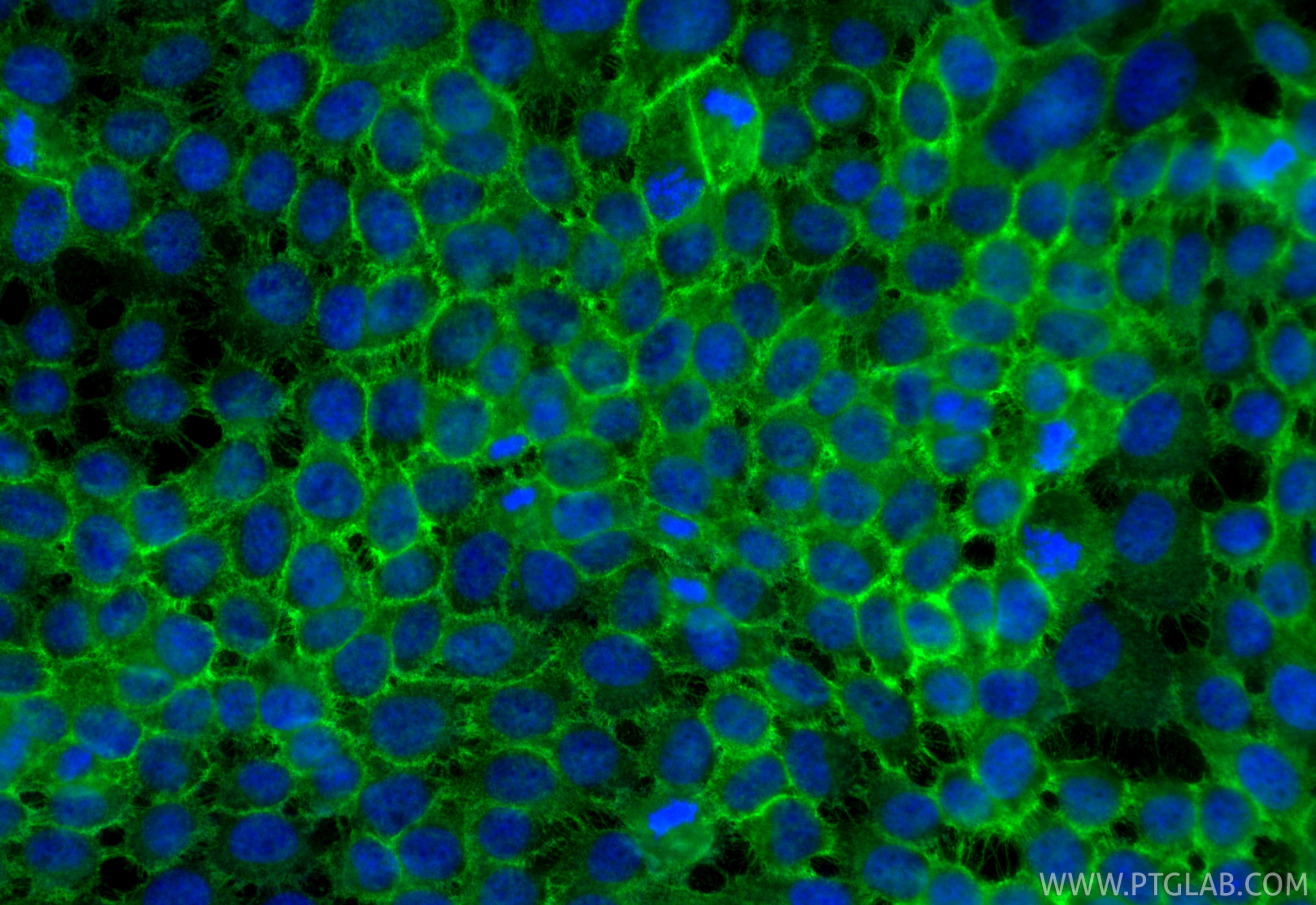 IF Staining of A431 using 31341-1-AP Immunofluorescence (IF) / fluorescent staining of A431 cells using CD138/Syndecan-1 Polyclonal antibody (31341-1-AP)