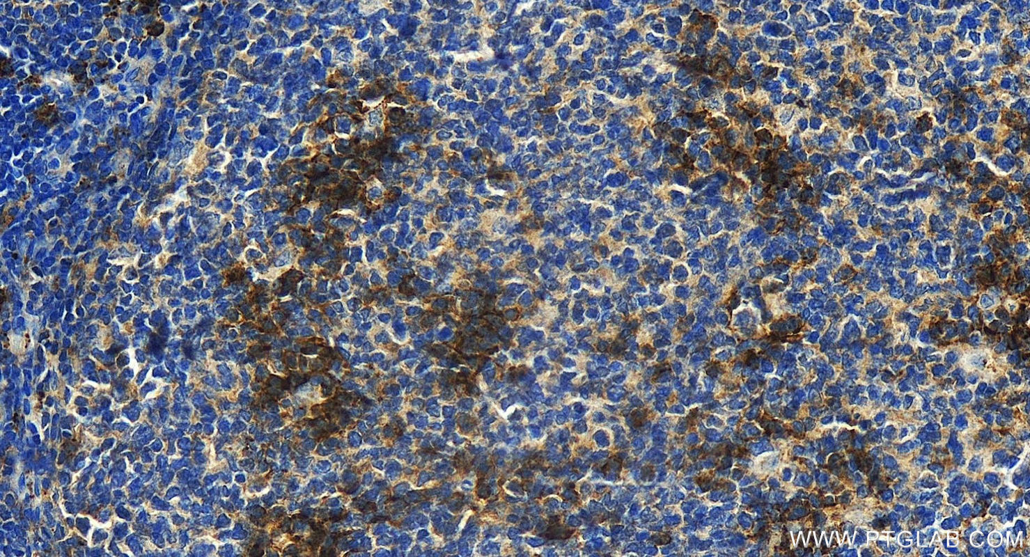CD138/Syndecan-1