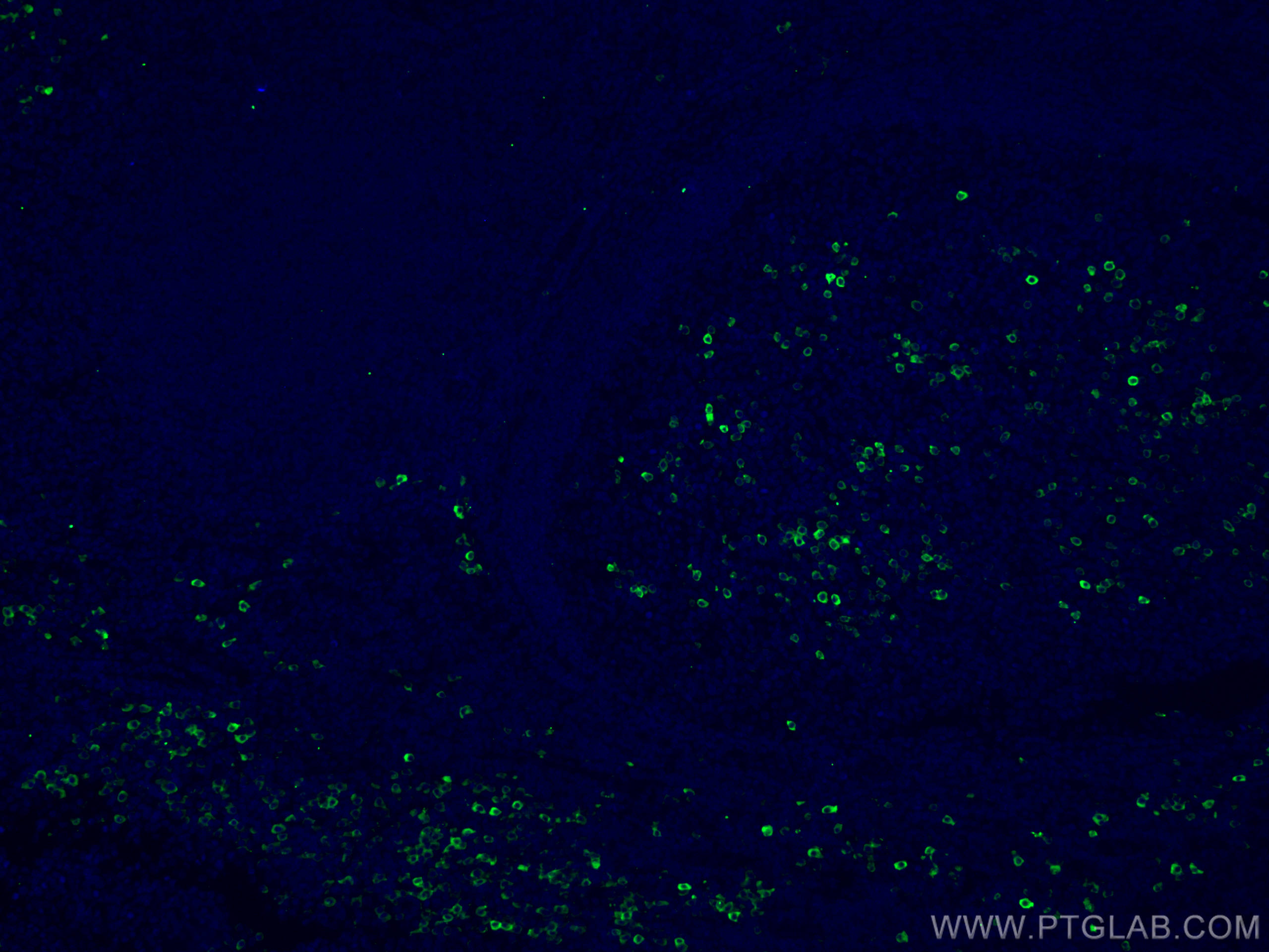 Immunofluorescence (IF) / fluorescent staining of human tonsillitis tissue using CD138/Syndecan-1 Monoclonal antibody (67155-1-Ig)