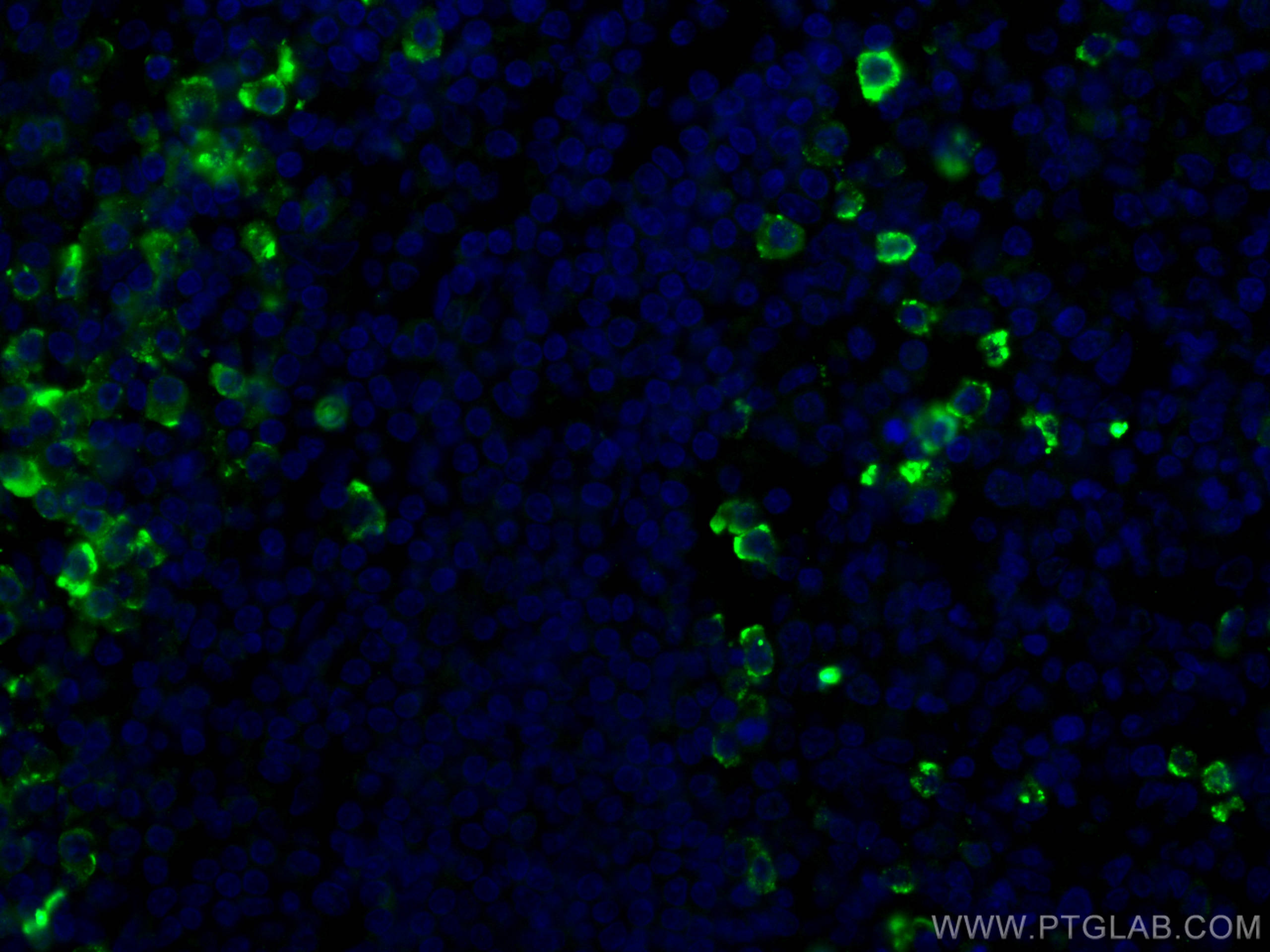 Immunofluorescence (IF) / fluorescent staining of human tonsillitis tissue using CD138/Syndecan-1 Monoclonal antibody (67155-1-Ig)