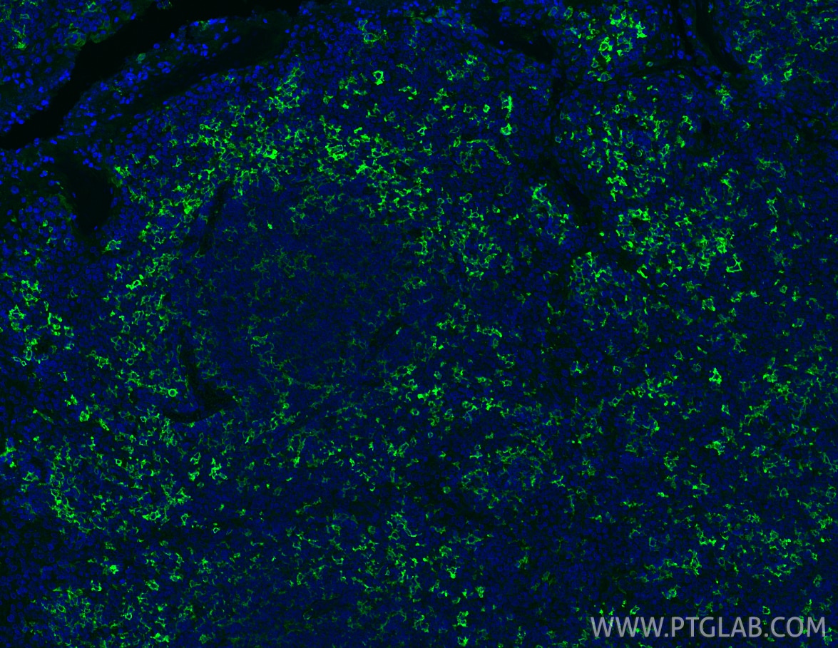Immunofluorescence (IF) / fluorescent staining of human tonsillitis tissue using CD14 Polyclonal antibody (17000-1-AP)