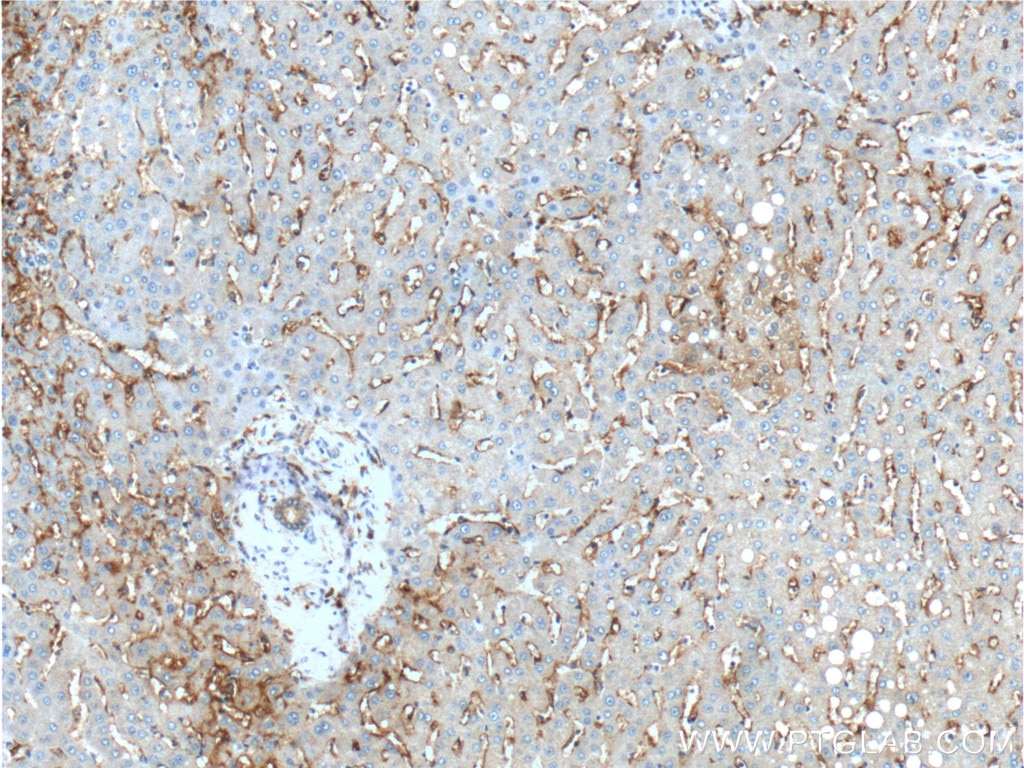 CD14 Polyclonal antibody