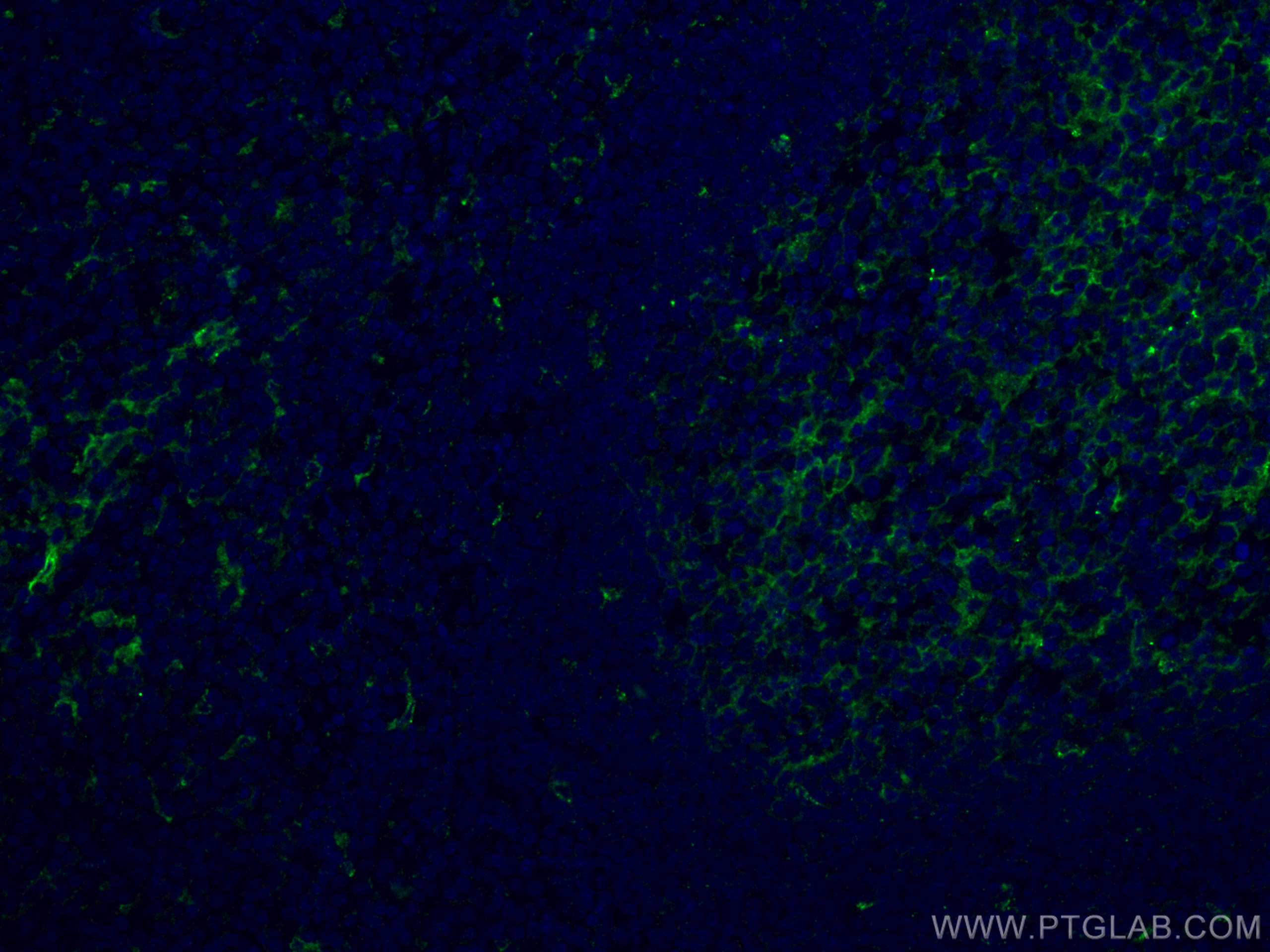 Immunofluorescence (IF) / fluorescent staining of human tonsillitis tissue using CD14 Monoclonal antibody (60253-1-Ig)