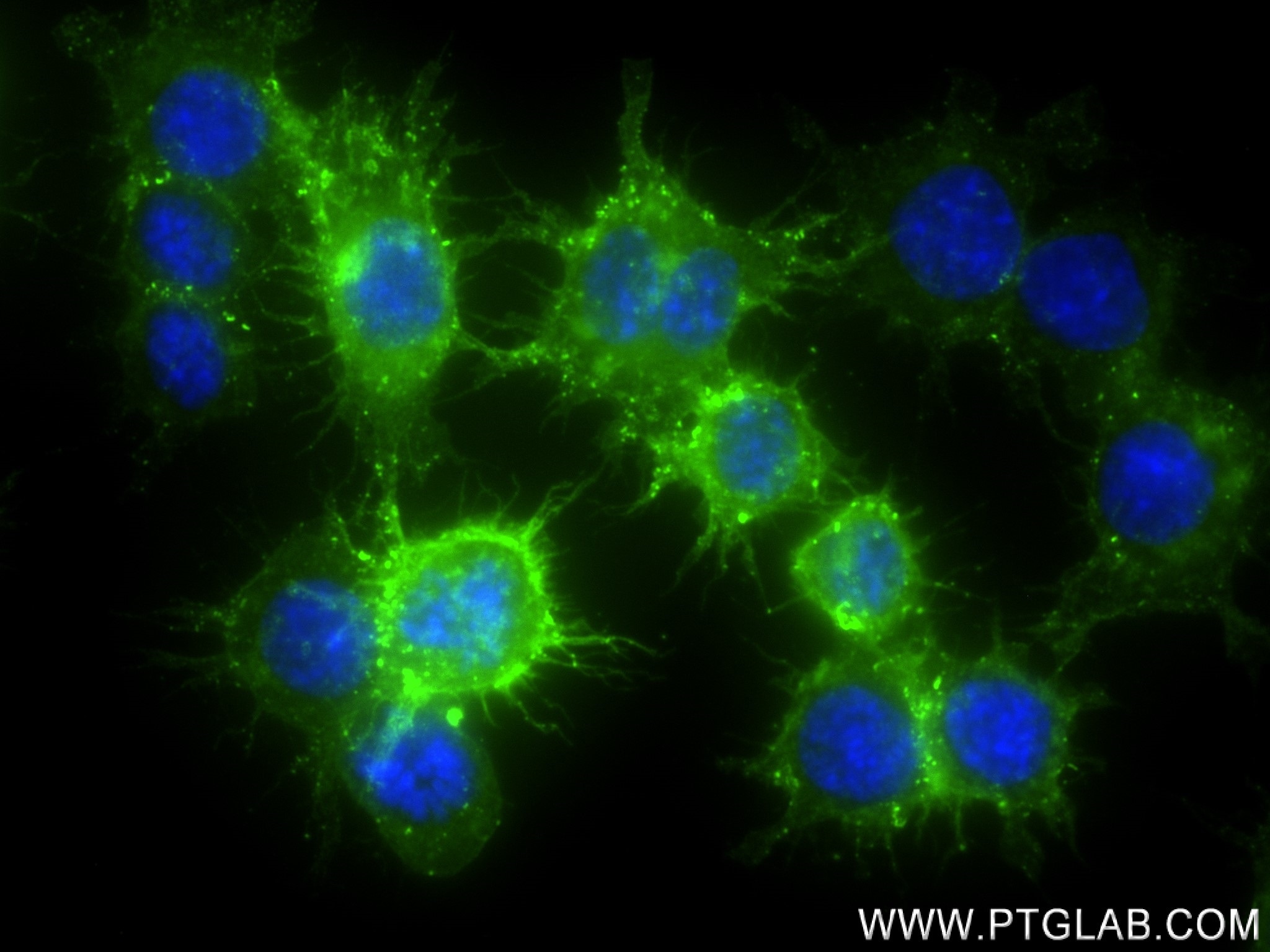 Immunofluorescence (IF) / fluorescent staining of RAW 264.7 cells using CD14 Recombinant antibody (83297-5-RR)