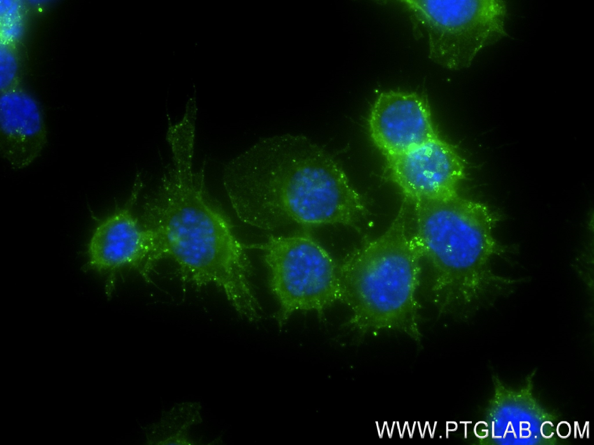 Immunofluorescence (IF) / fluorescent staining of RAW 264.7 cells using CD14 Recombinant antibody (83297-6-RR)